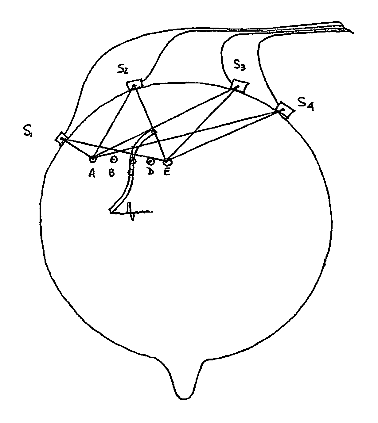 Noninvasive detection of human brain conditions and anomalies