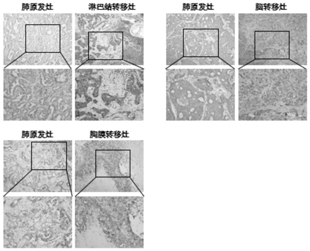 Application of SRC inhibitor and FAK inhibitor in preparation of medicine for inhibiting lung cancer metastasis