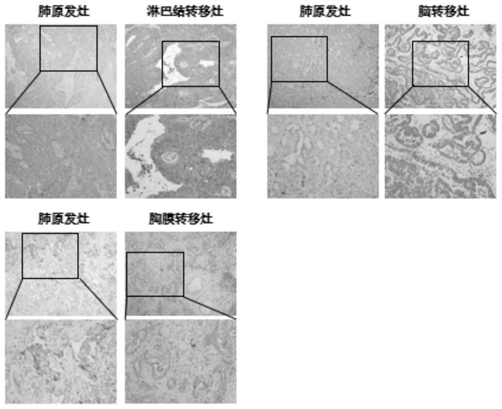 Application of SRC inhibitor and FAK inhibitor in preparation of medicine for inhibiting lung cancer metastasis