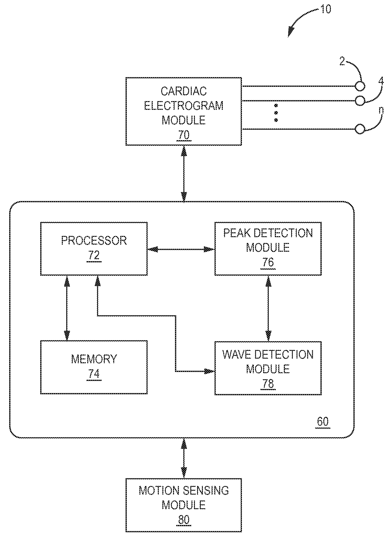 Determining onset of cardiac depolarization and repolarization waves for signal processing