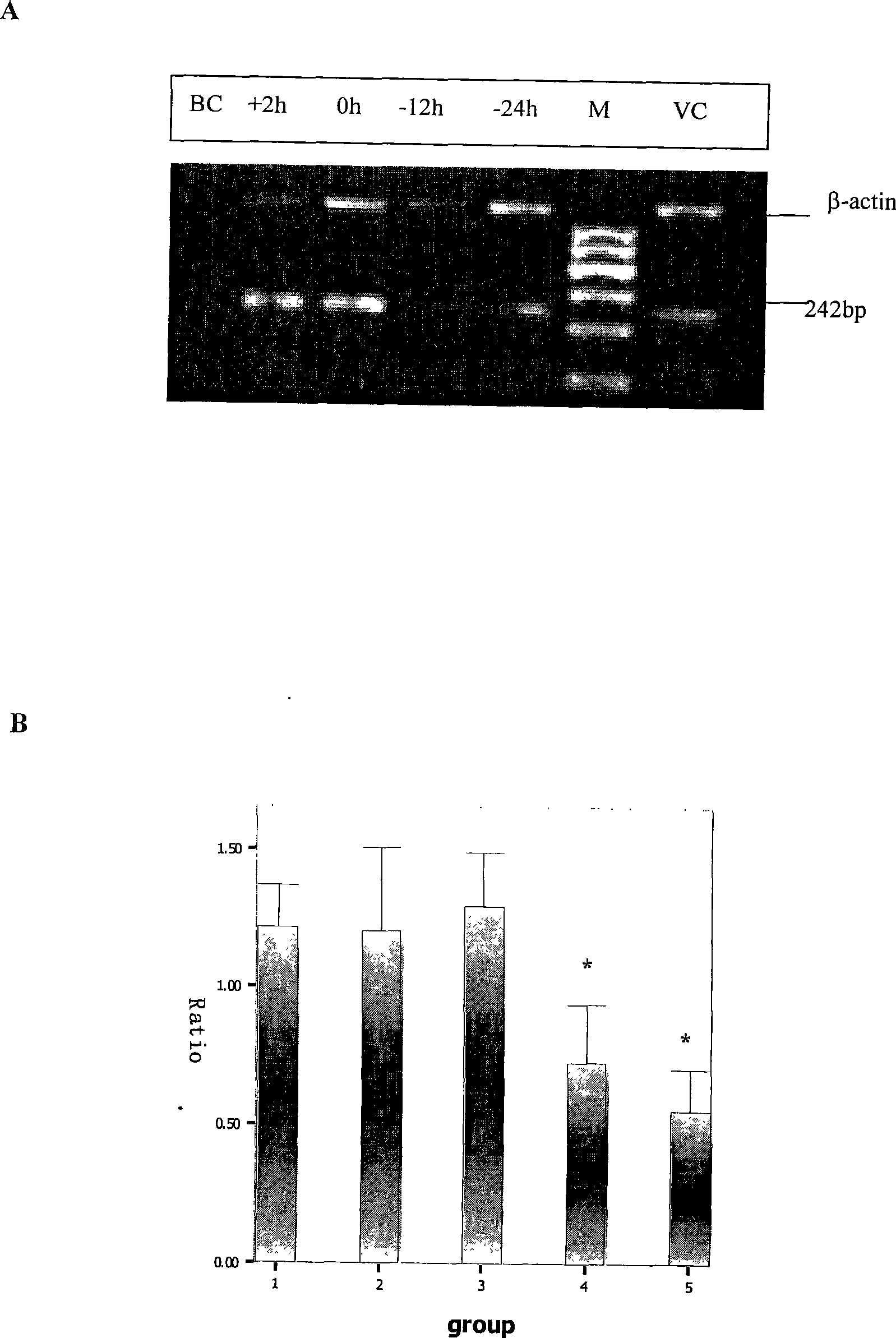 Use of anti-hantavirus medicament arbidol