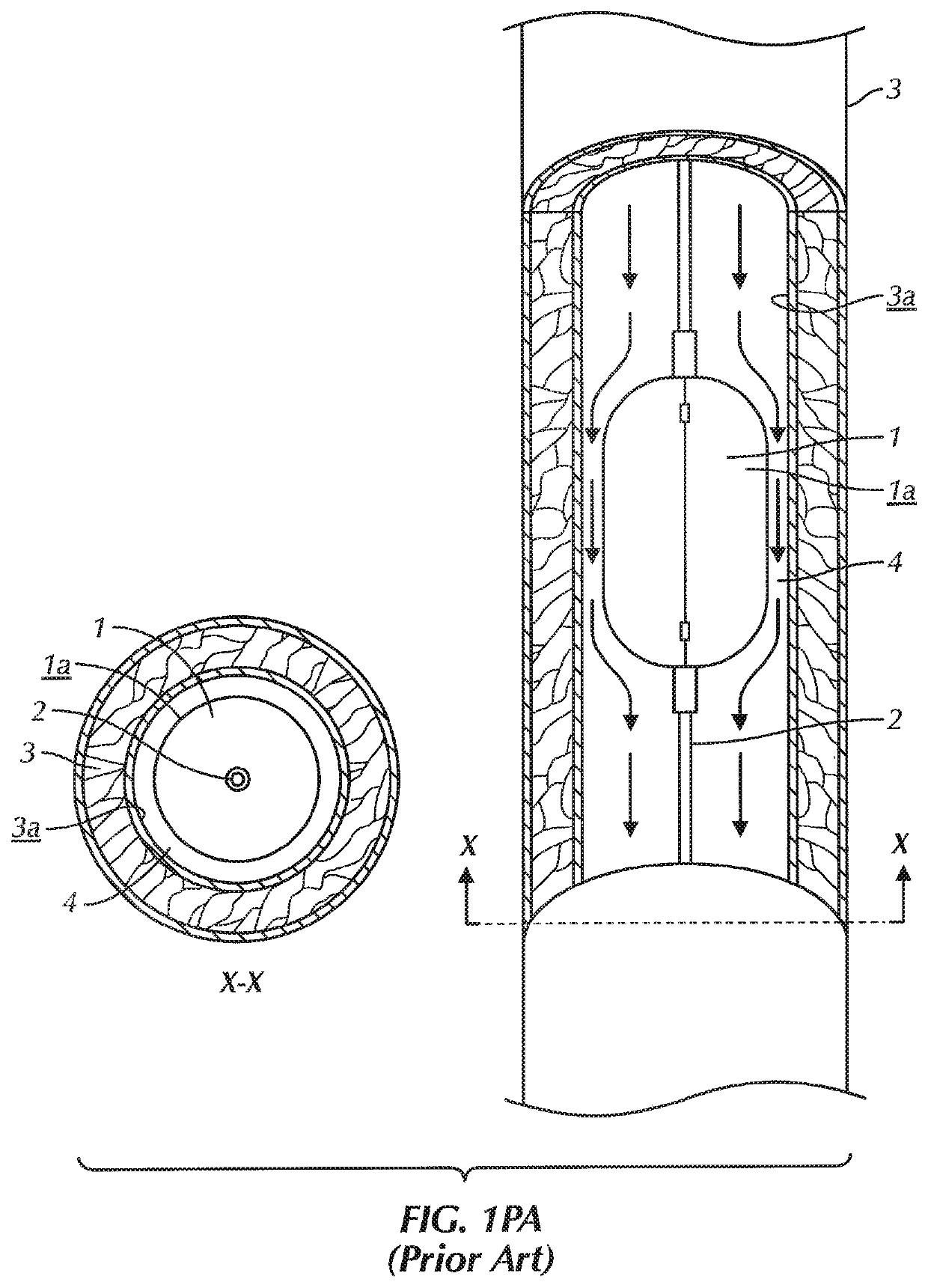 System and method for low profile occlusion balloon catheter