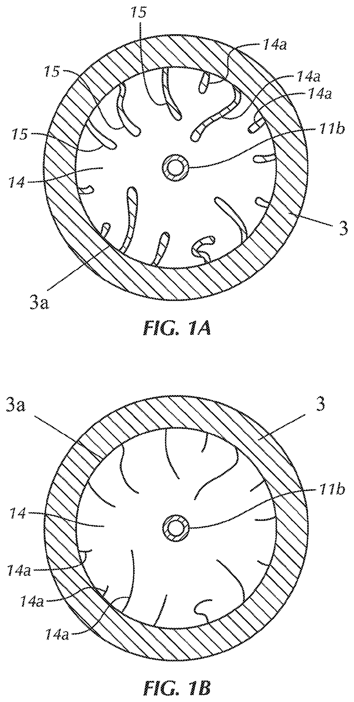 System and method for low profile occlusion balloon catheter