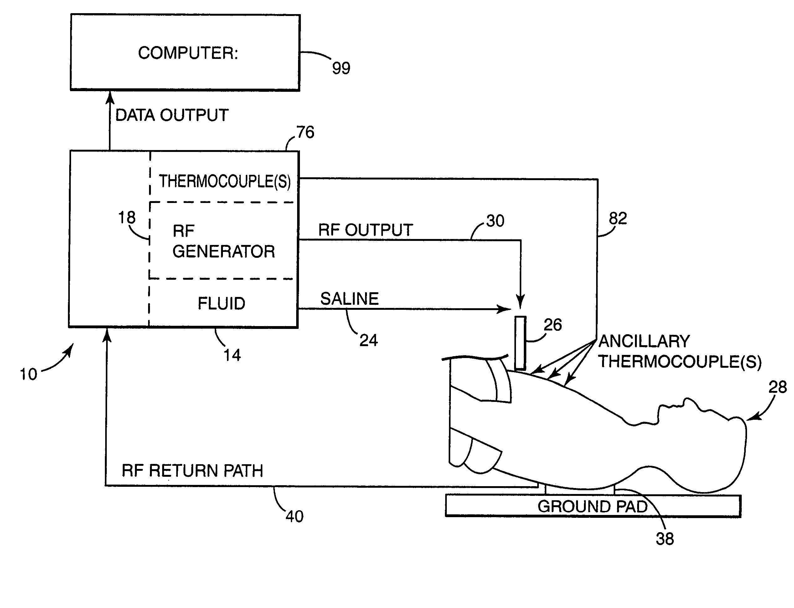 Apparatus and method for creating, maintaining, and controlling a virtual electrode used for the ablation of tissue