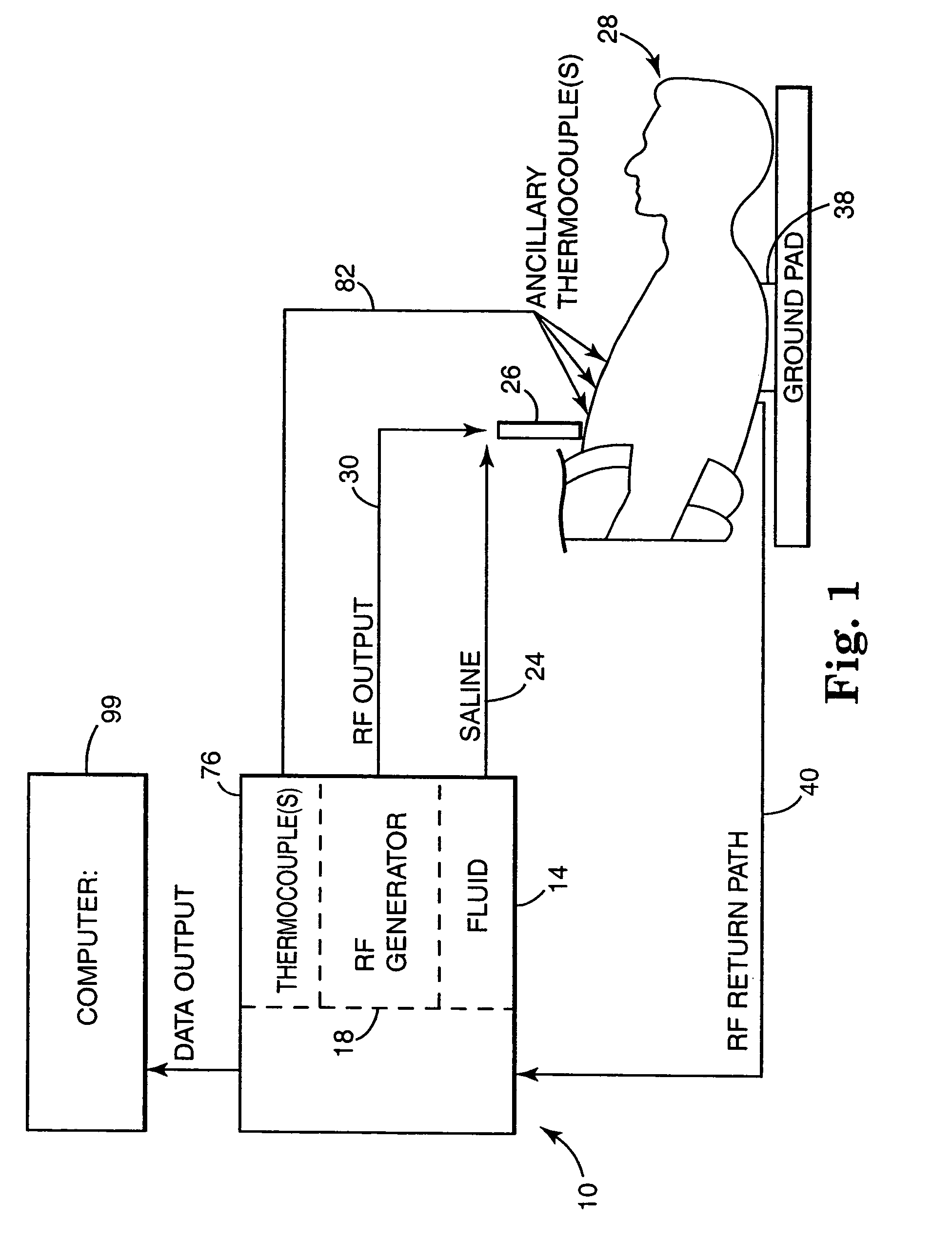 Apparatus and method for creating, maintaining, and controlling a virtual electrode used for the ablation of tissue