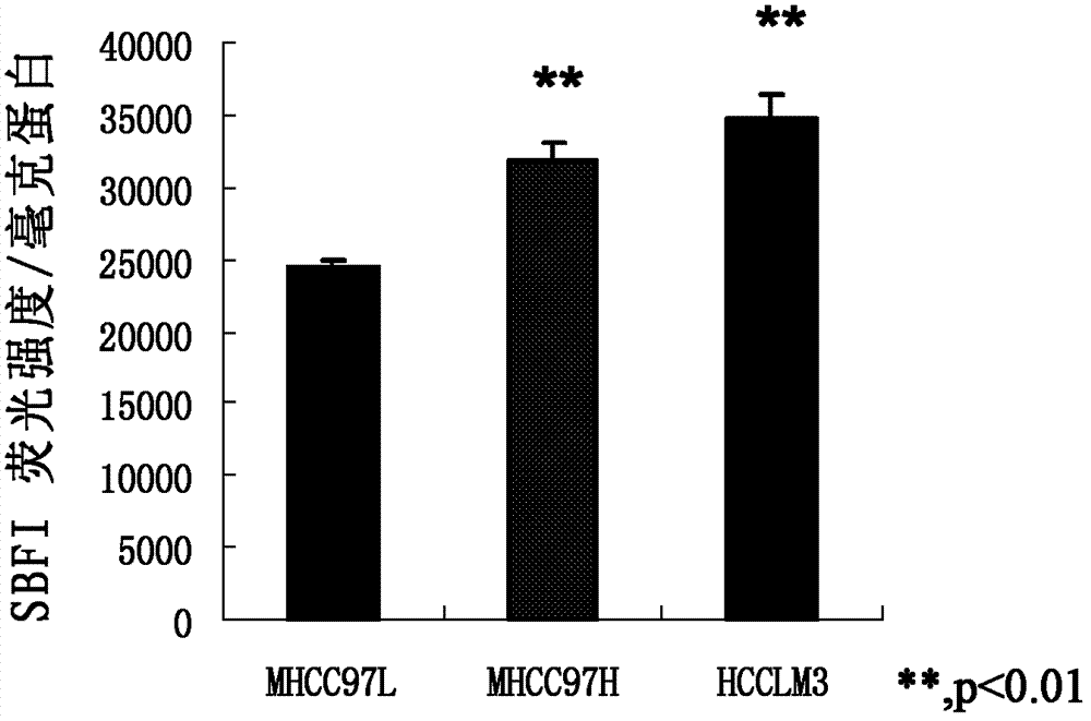 Application of bumetanide in inhibition of hepatoma cell transfer