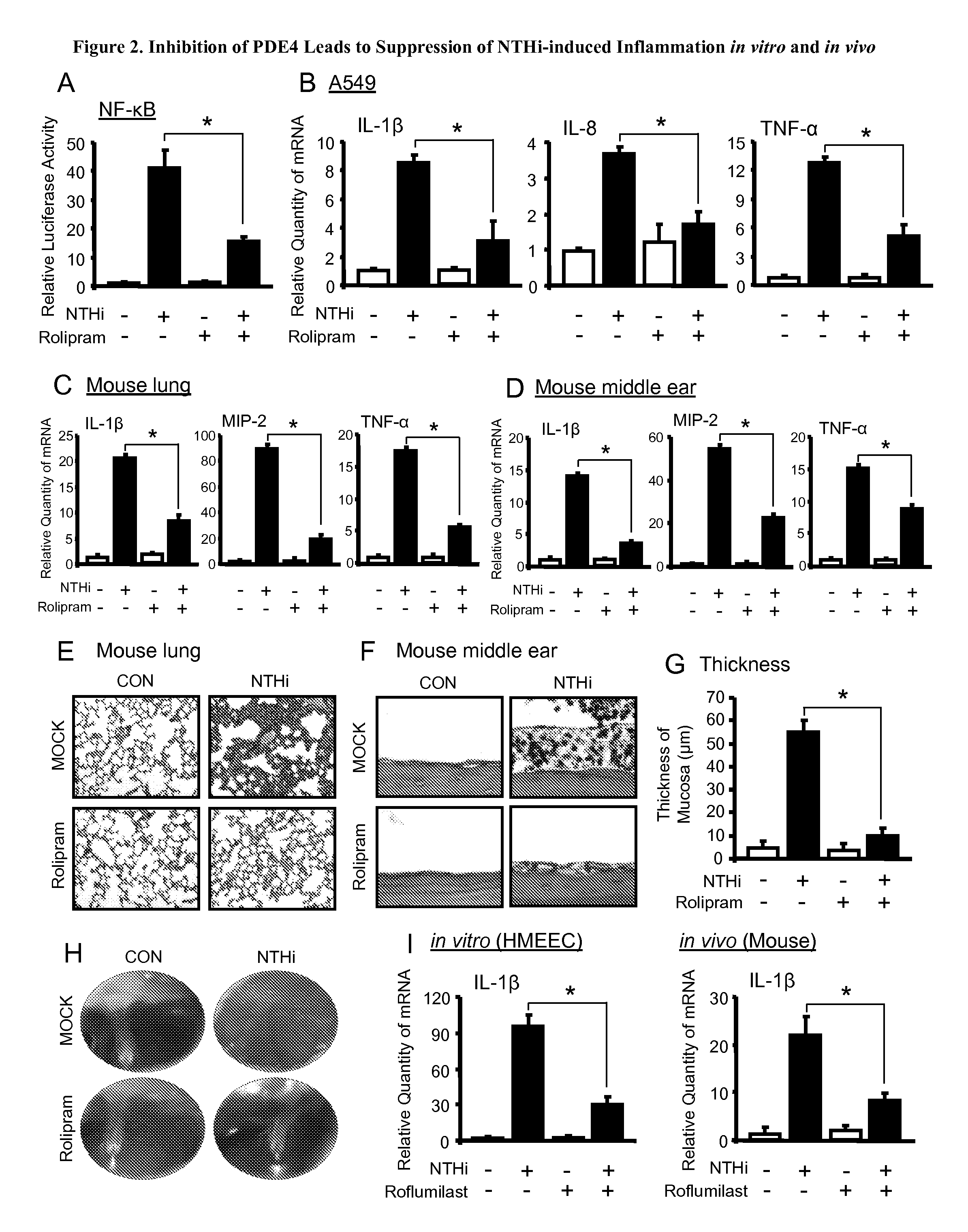 Compositions and methods for treating otitis media and other conditions with inhibitors of cyld