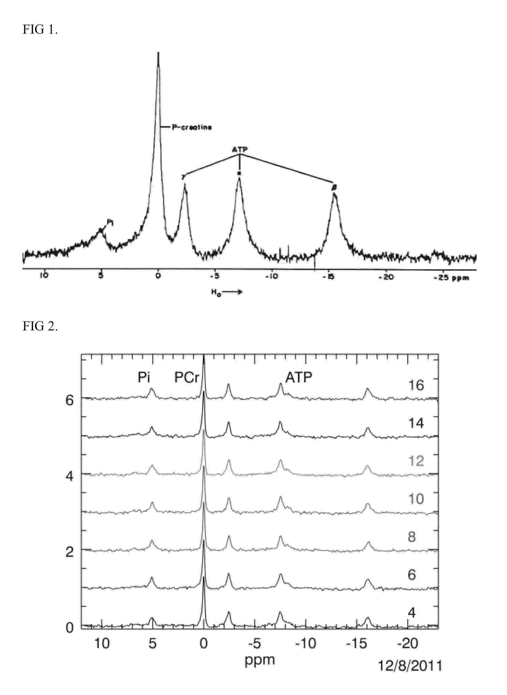 Use of 31P NMR spectroscopy of whole heart energetics for detection of drug-induced cardiotoxicity