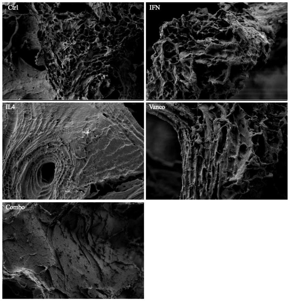 Tissue-engineered bone scaffold for treating infectious large bone defects as well as preparation method and application of tissue-engineered bone scaffold