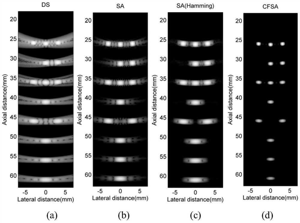 A Method for Optimizing Ultrasound Image Contrast and Lateral Resolution