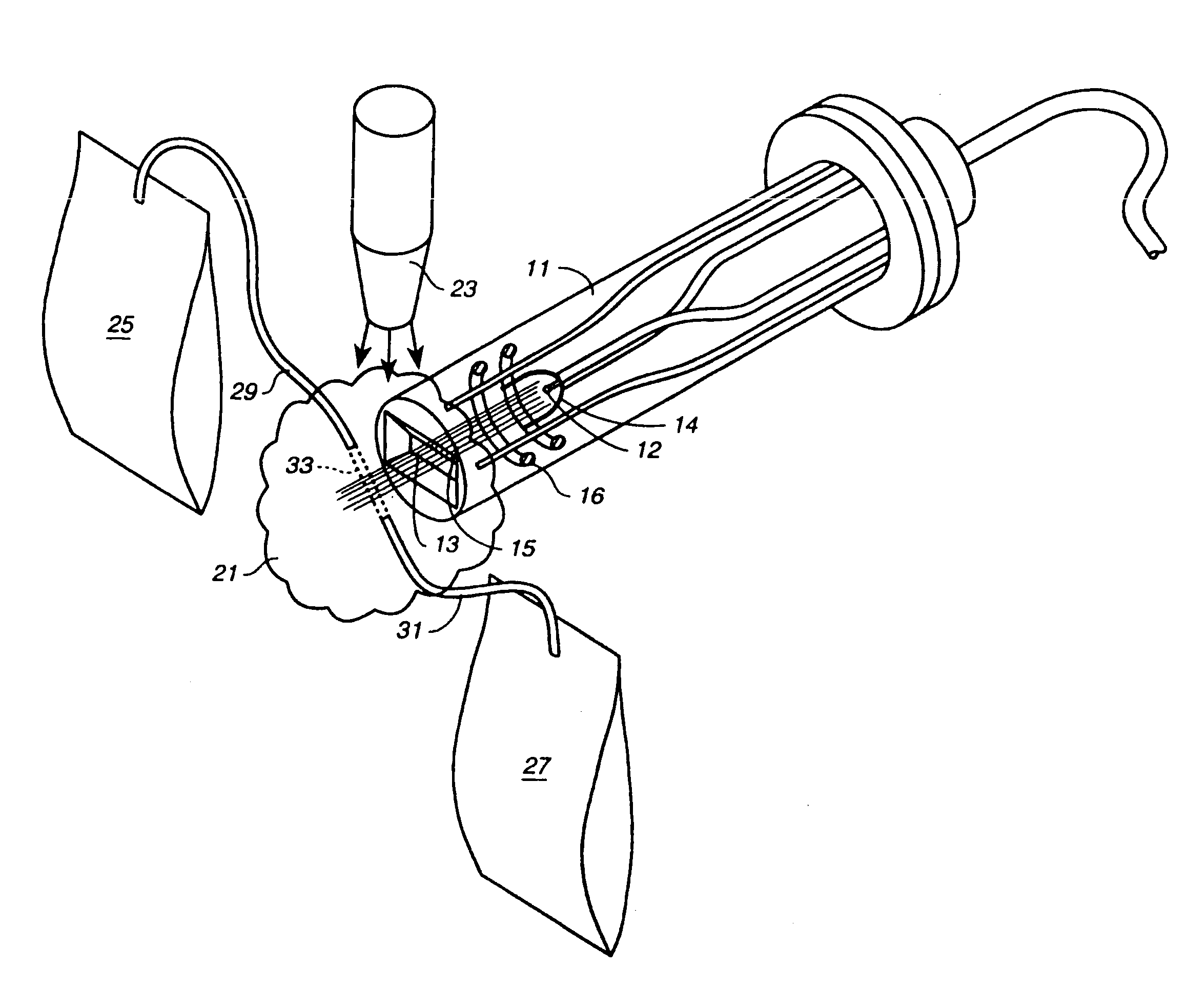 Sterilization by low energy electron beam