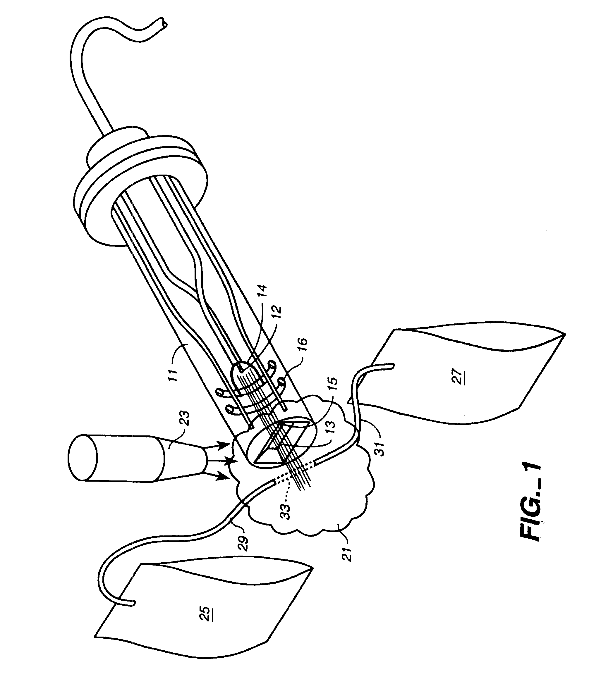 Sterilization by low energy electron beam