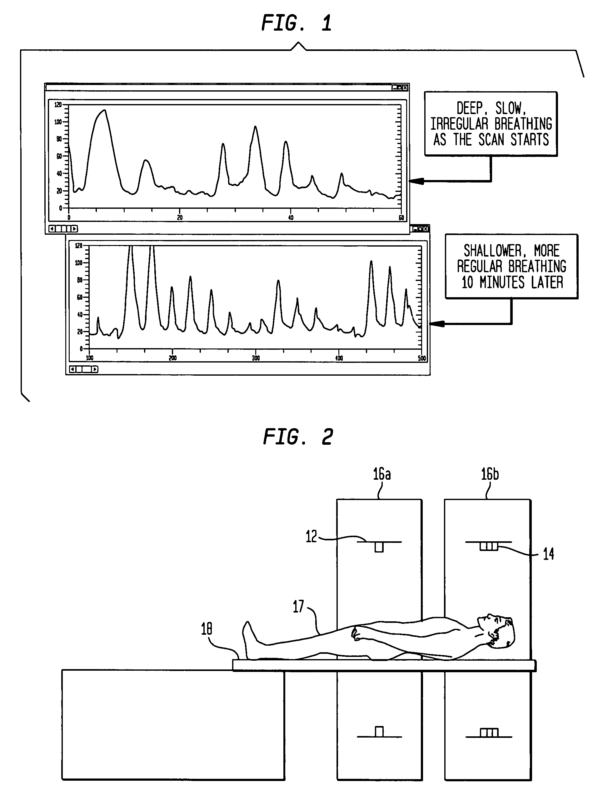 Registration of computed tomography (CT) and positron emission tomography (PET) image scans with automatic patient motion correction