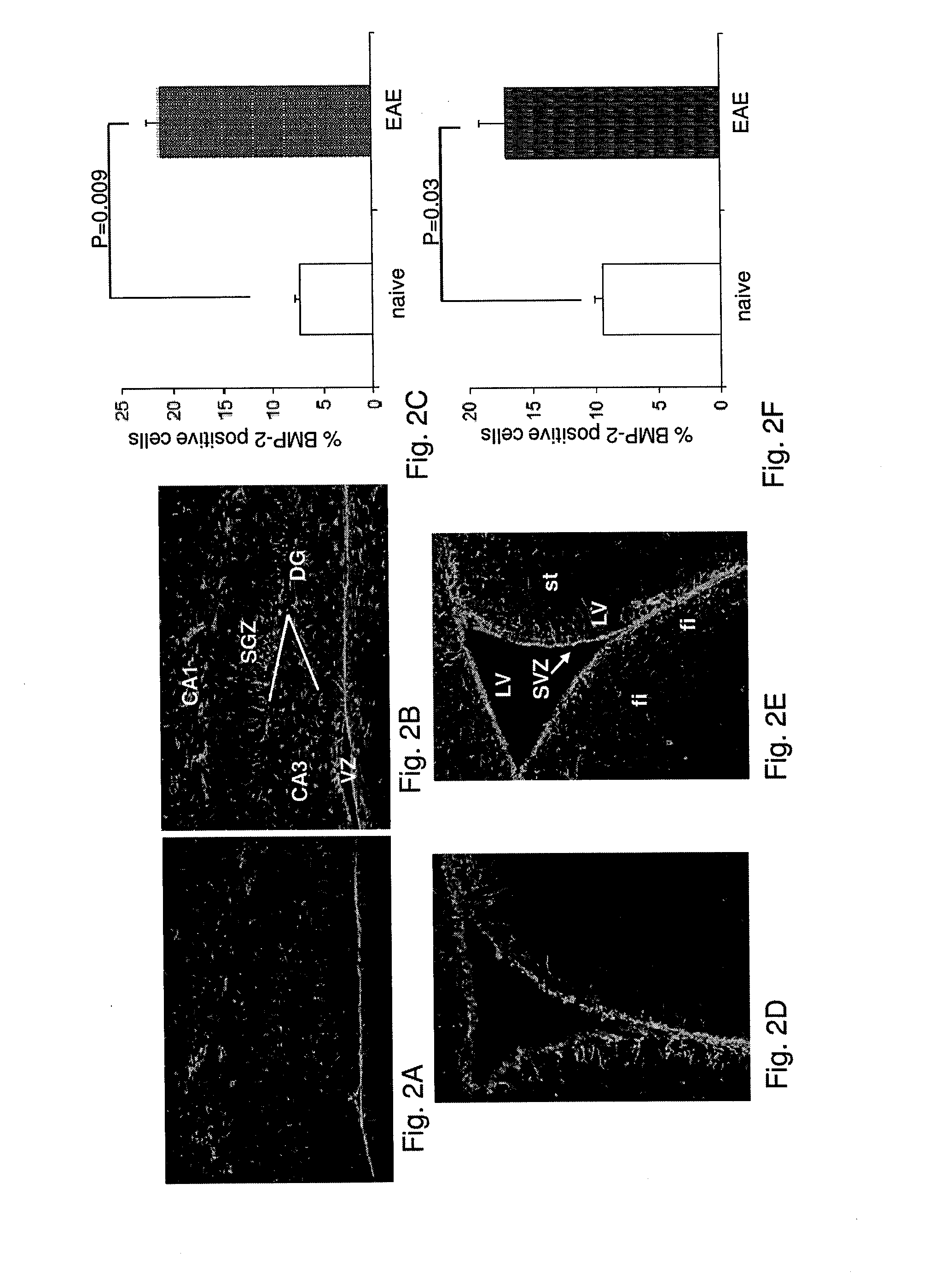 Use of blocking agents of bone morphogenic protein (BMP) signalling for the treatment of neuroinflammatory and neurodegenerative diseases