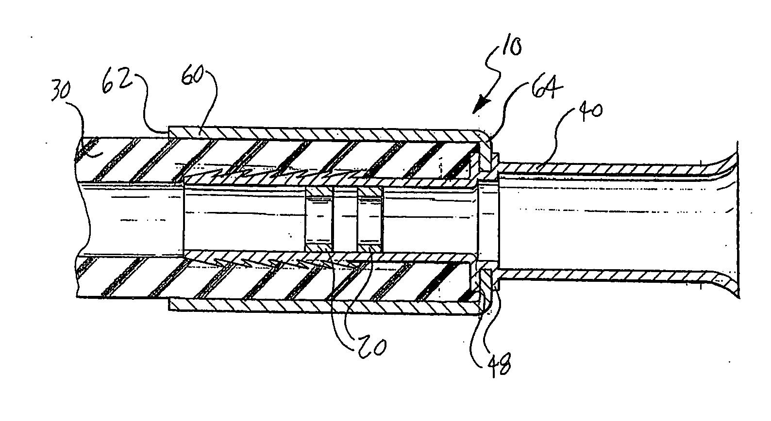 Reinforcement for a hose coupling