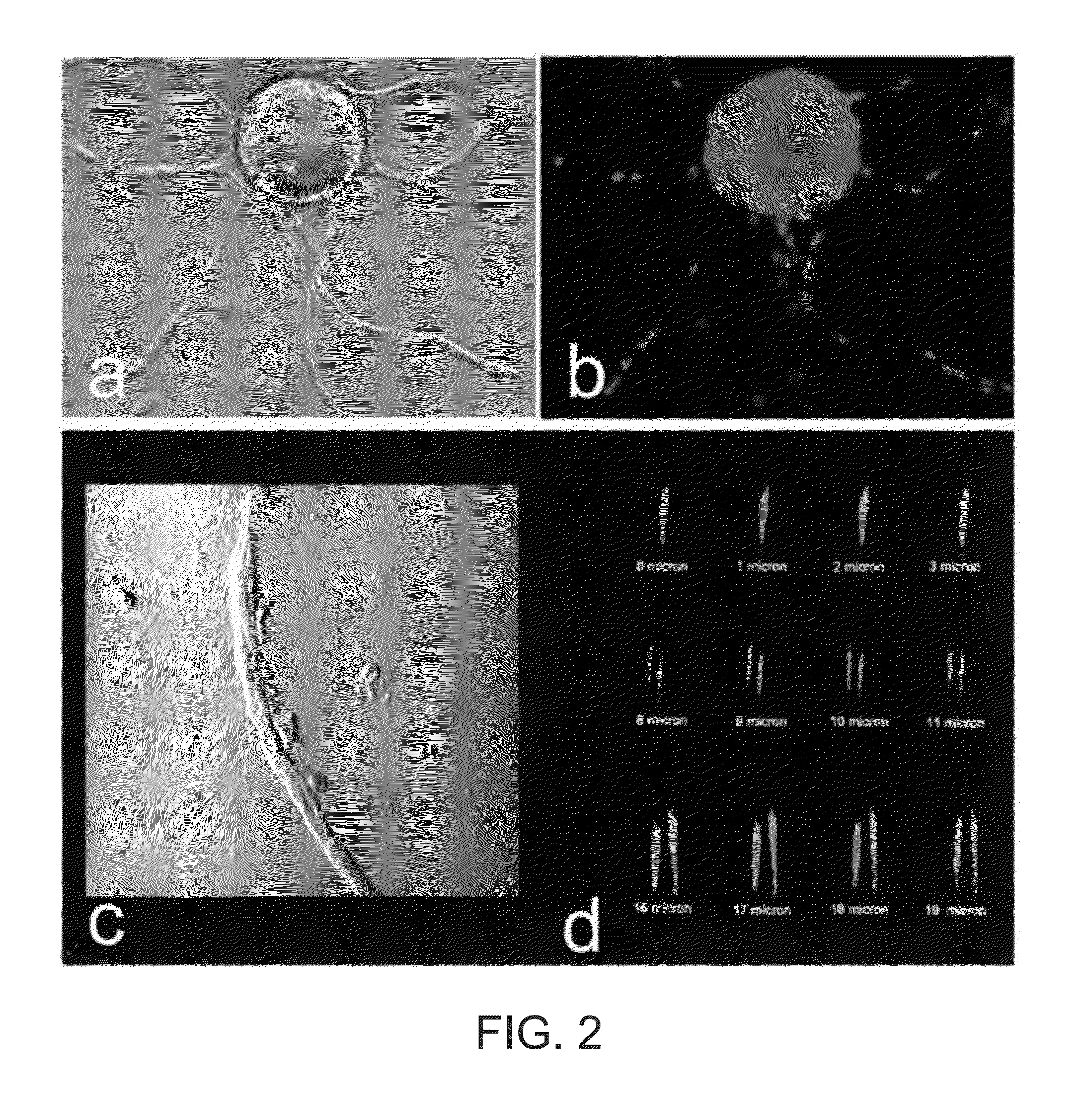 Formulations having an alpha v beta 3 antagonist and an alpha 2 beta 1 antagonist for Anti-angionic therapy