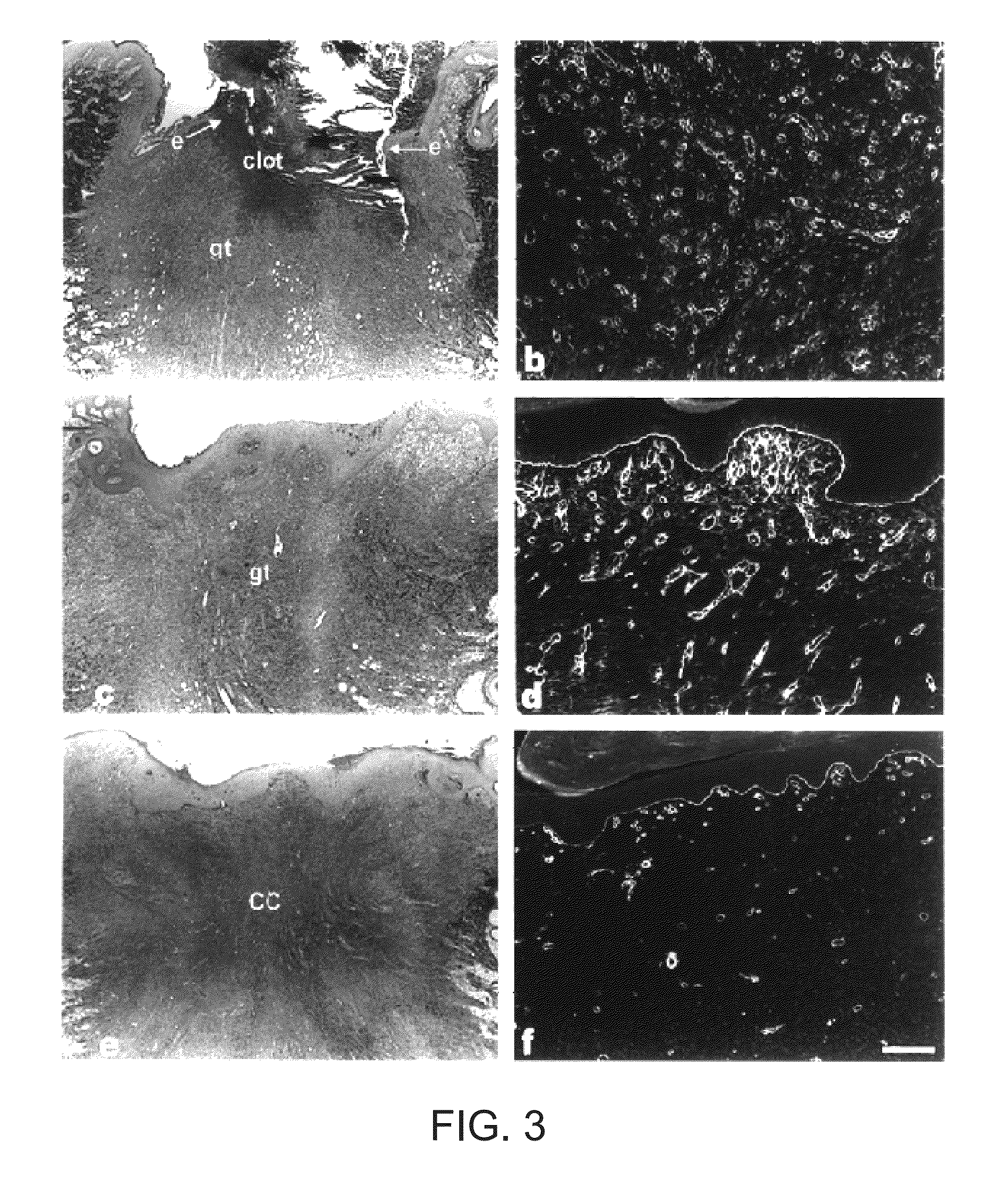 Formulations having an alpha v beta 3 antagonist and an alpha 2 beta 1 antagonist for Anti-angionic therapy