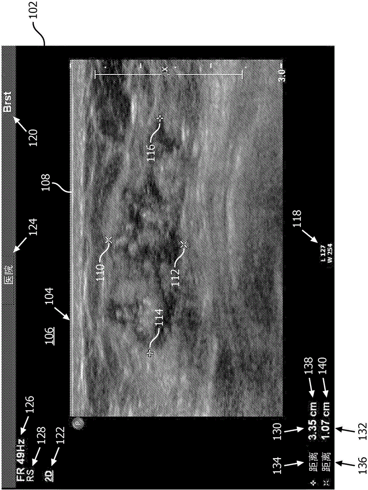 Extraction of information from an image and inclusion thereof in a clinical report