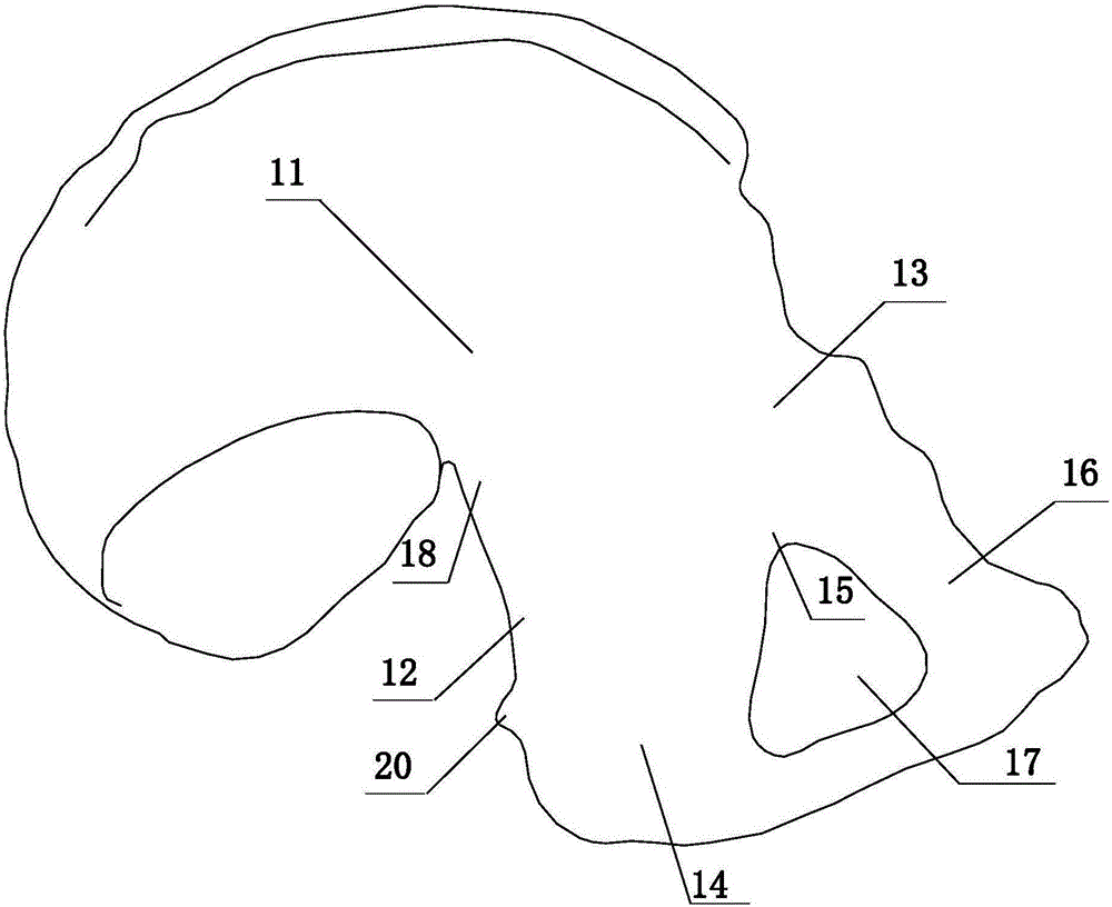 Fixation device and method for acetabular anterior and posterior columns and quadrangular fractures