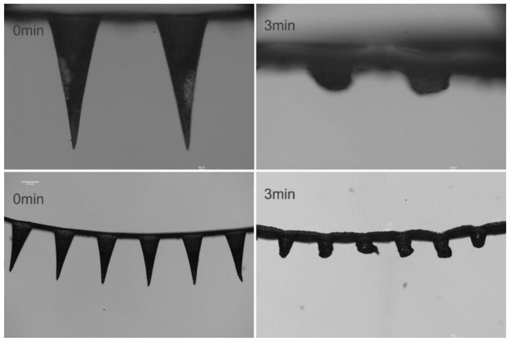 Instant collagen microneedle and preparation method thereof