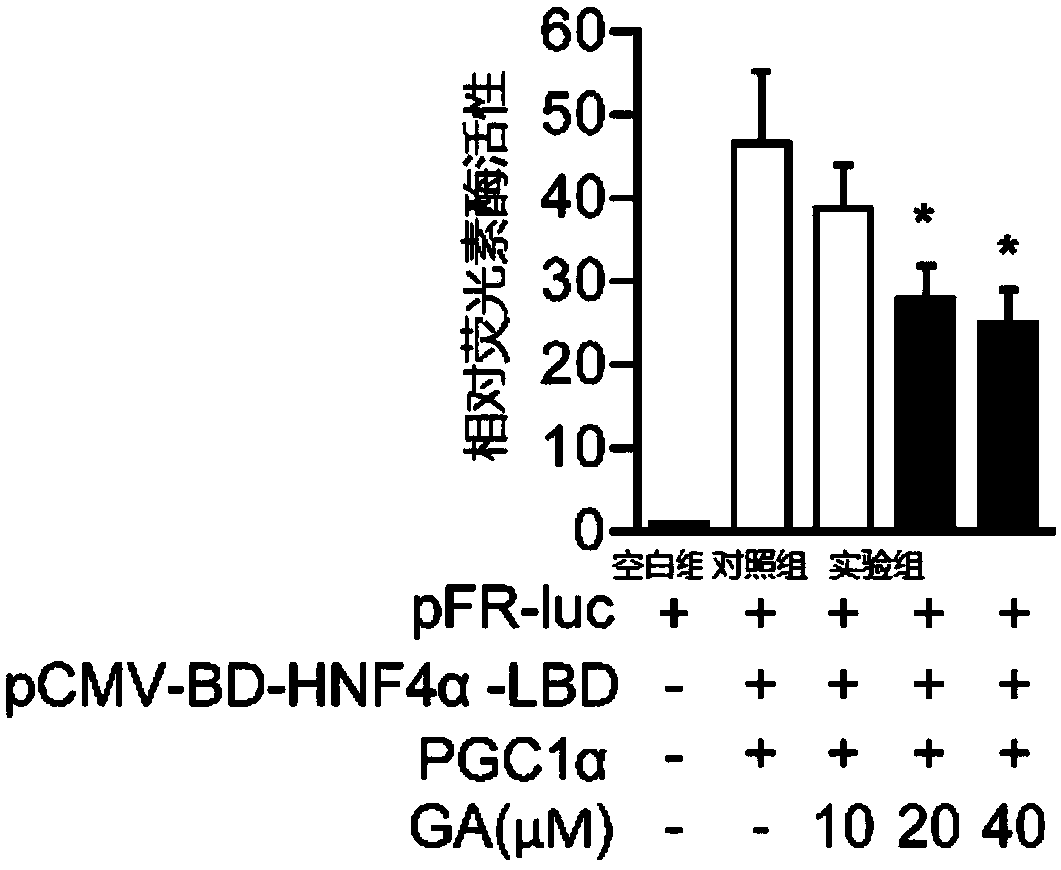 Applications of 18beta-glycyrrhetinic acid in preparation drugs for diseases related to abnormal lipid metabolism