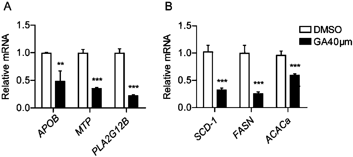 Applications of 18beta-glycyrrhetinic acid in preparation drugs for diseases related to abnormal lipid metabolism