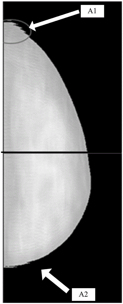 Correction method and device for sawtooth artifacts in digital breast mammary tomographic reconstruction