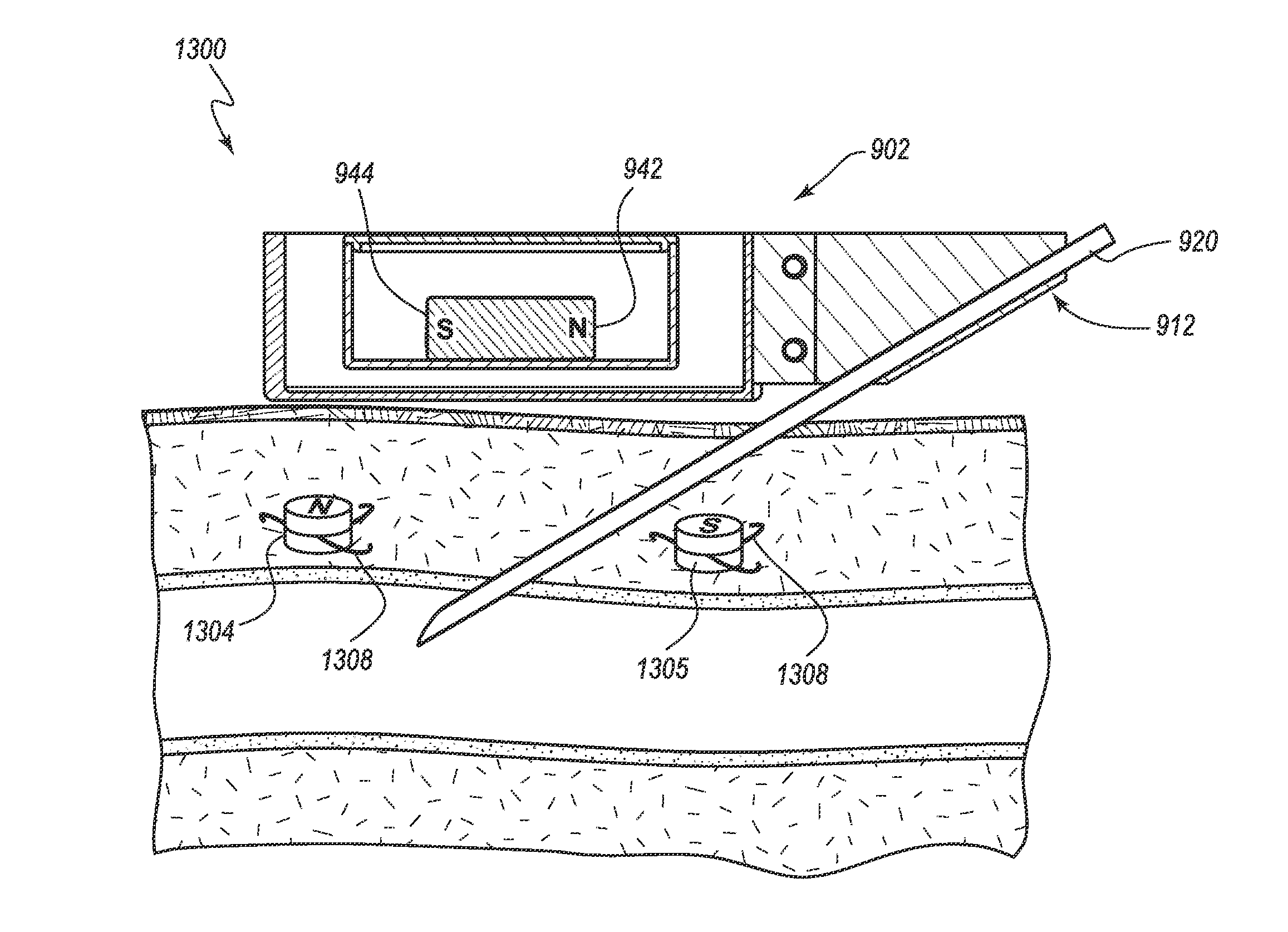 Detection and guide systems and methods for accessing blood vessels