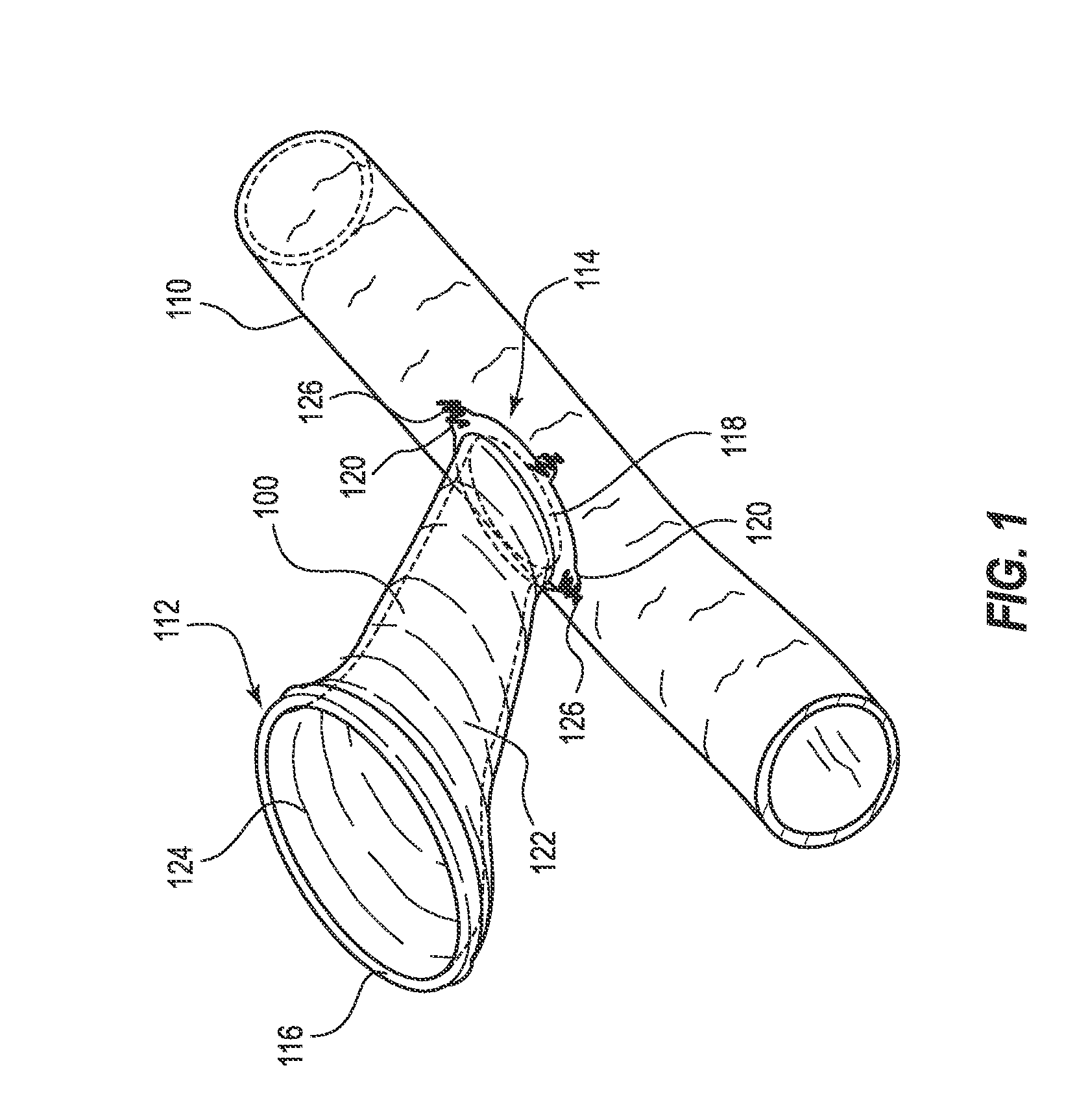 Detection and guide systems and methods for accessing blood vessels