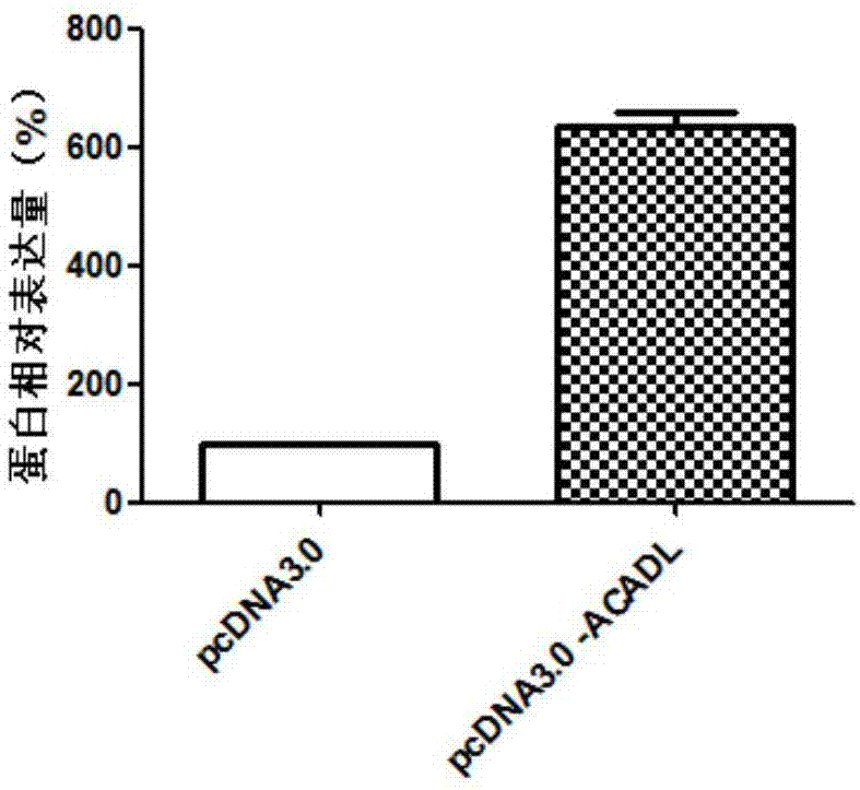 ACADL gene and application of expression product of ACADL gene to preparation of abdominal aortic aneurysm diagnosis and treatment product