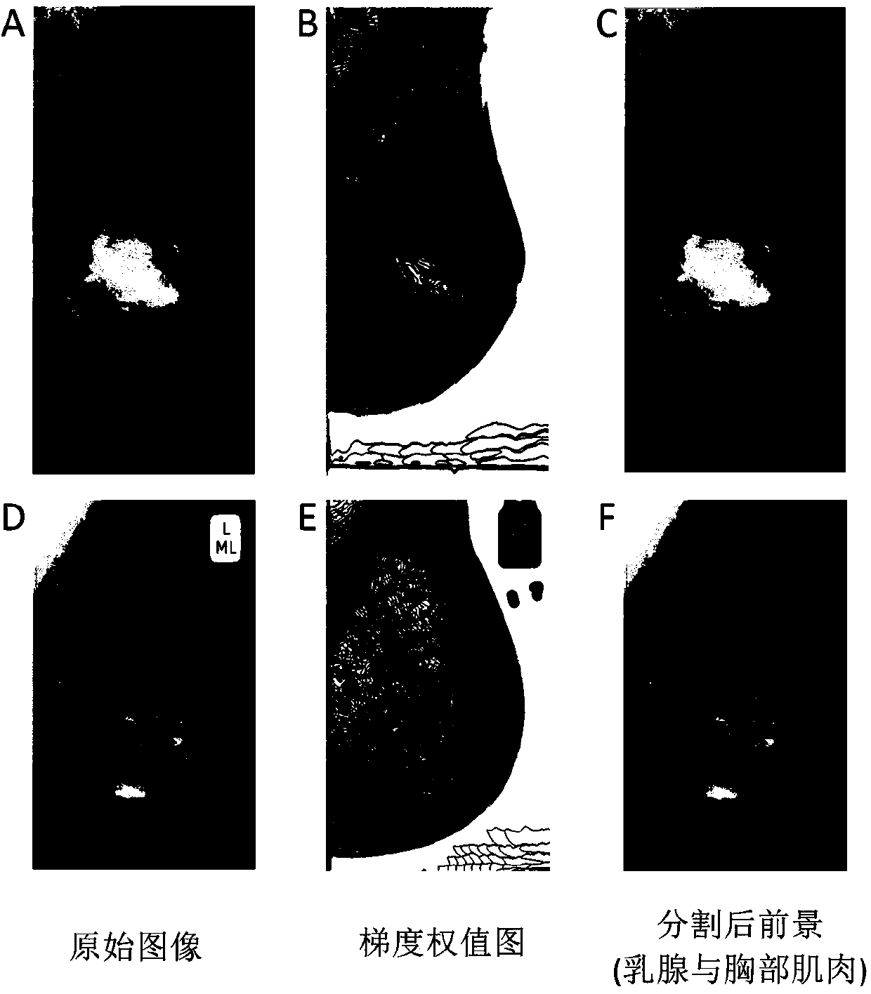 Lightweight neural network-based mammary molybdenum target image deep learning classification method