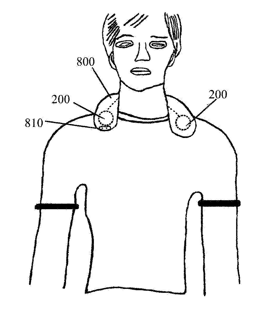 Methods and Devices for Treating Hypertension