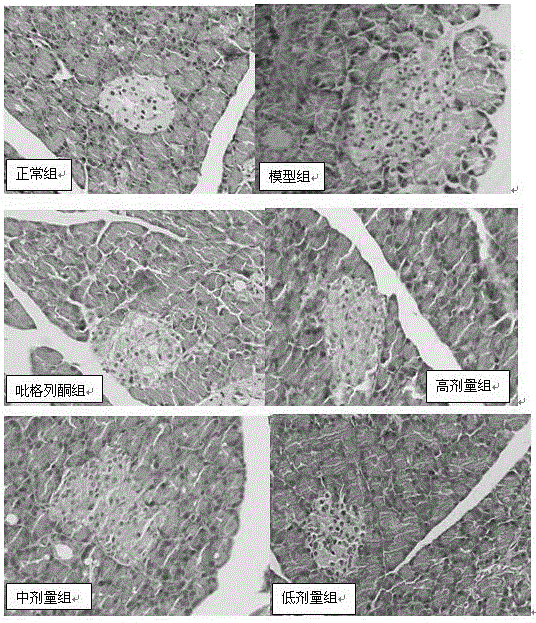 Deverage capable of tonifying spleen and invigorating pancreas and preparation method thereof