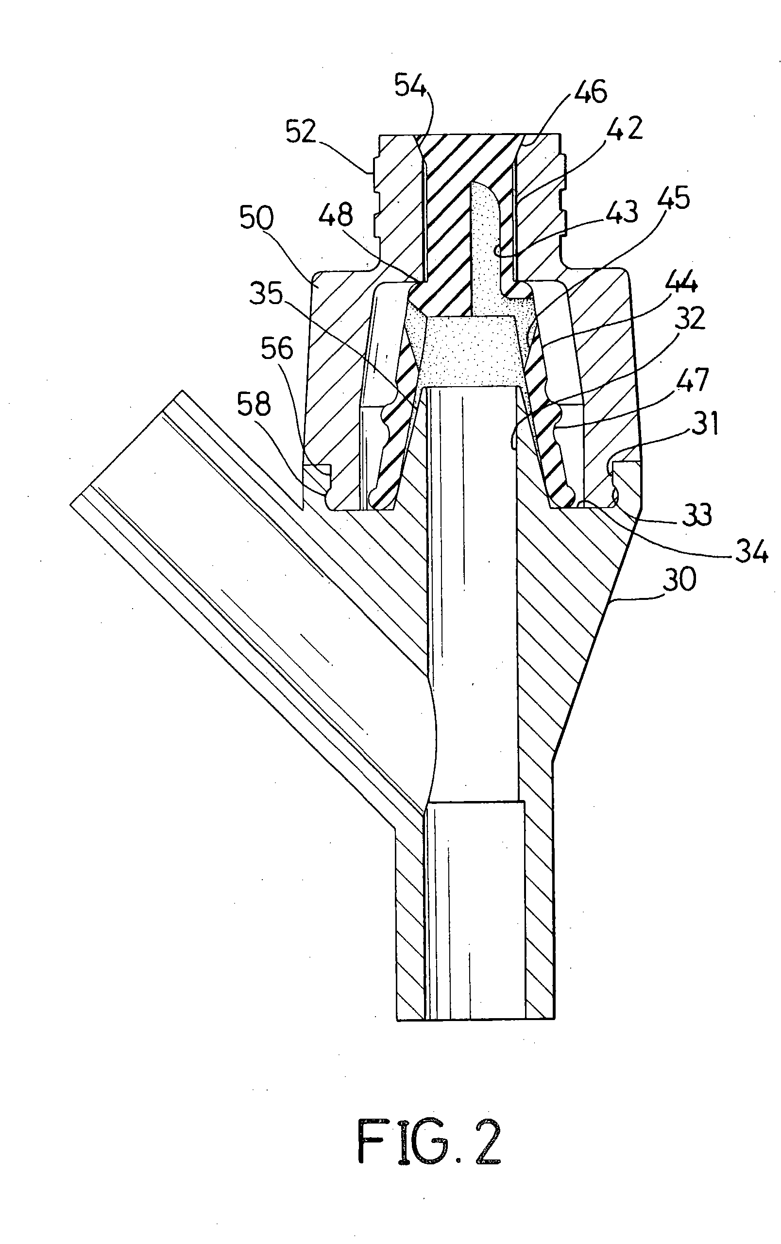 Injection joint for an intravenous (IV) device tube