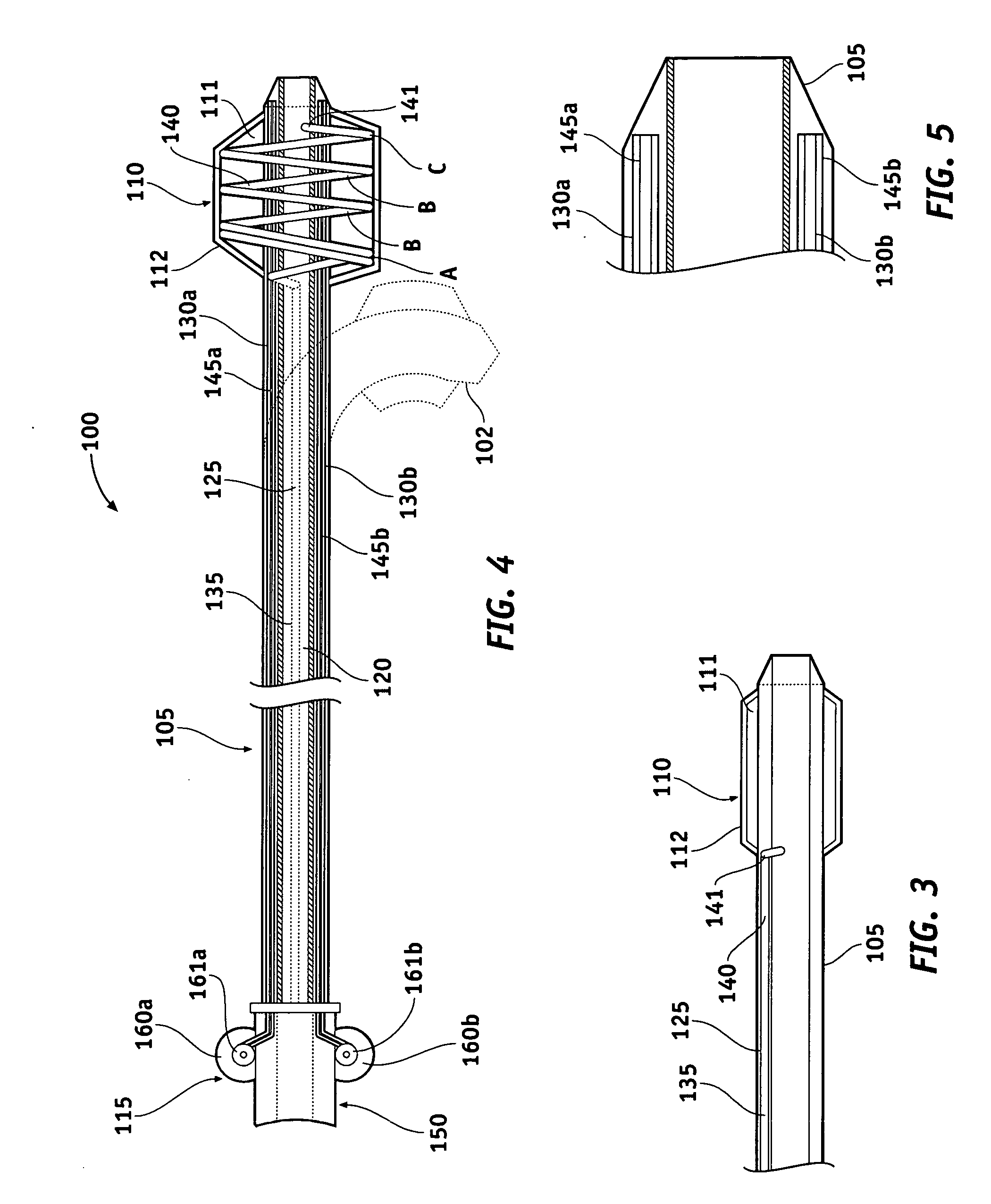 Guiding catheter with embolic protection by proximal occlusion