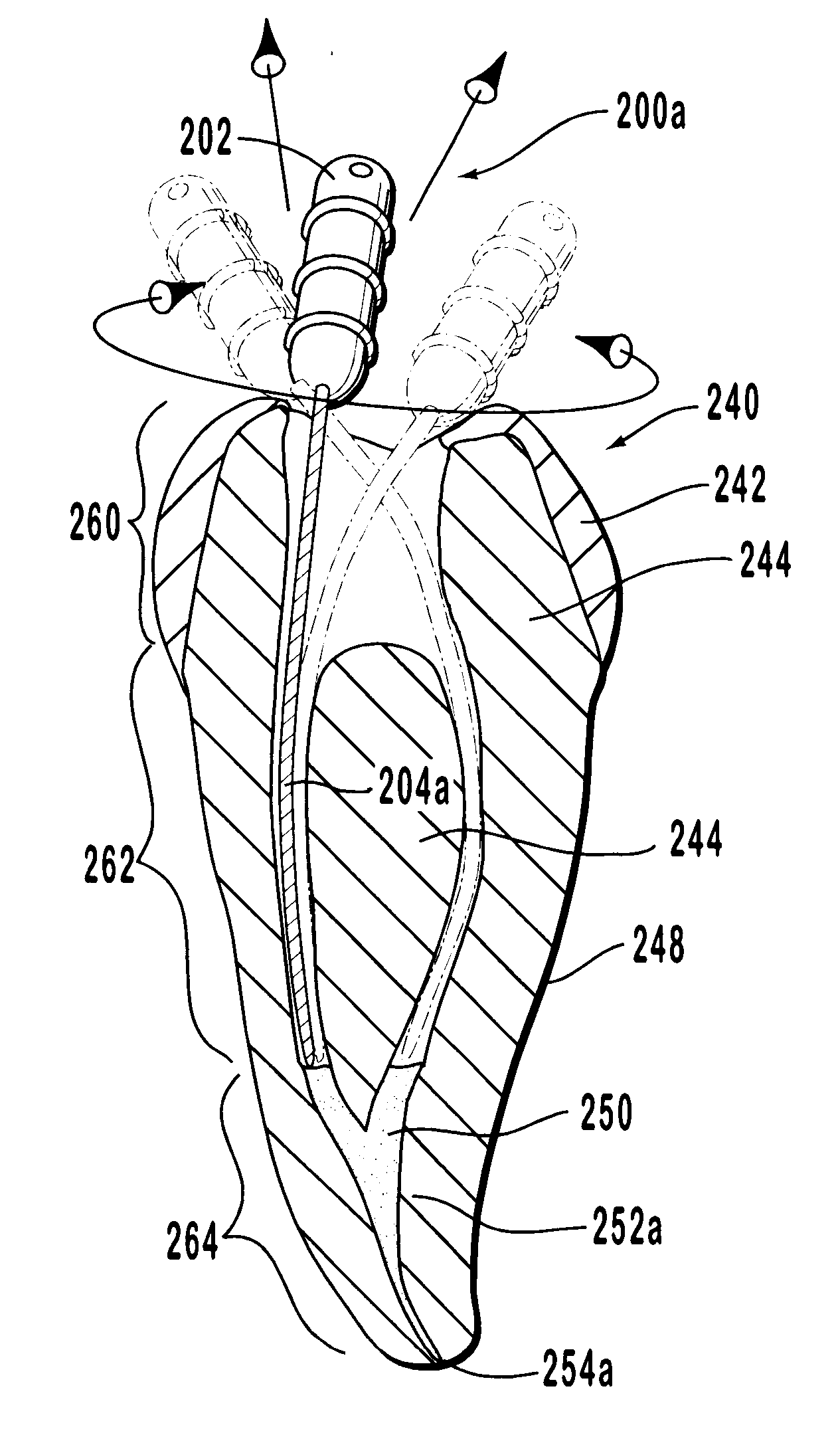 Endodontic systems and methods for the anatomicall, sectional and progressive corono-apical preparation of root canals with minimal apical intrusion