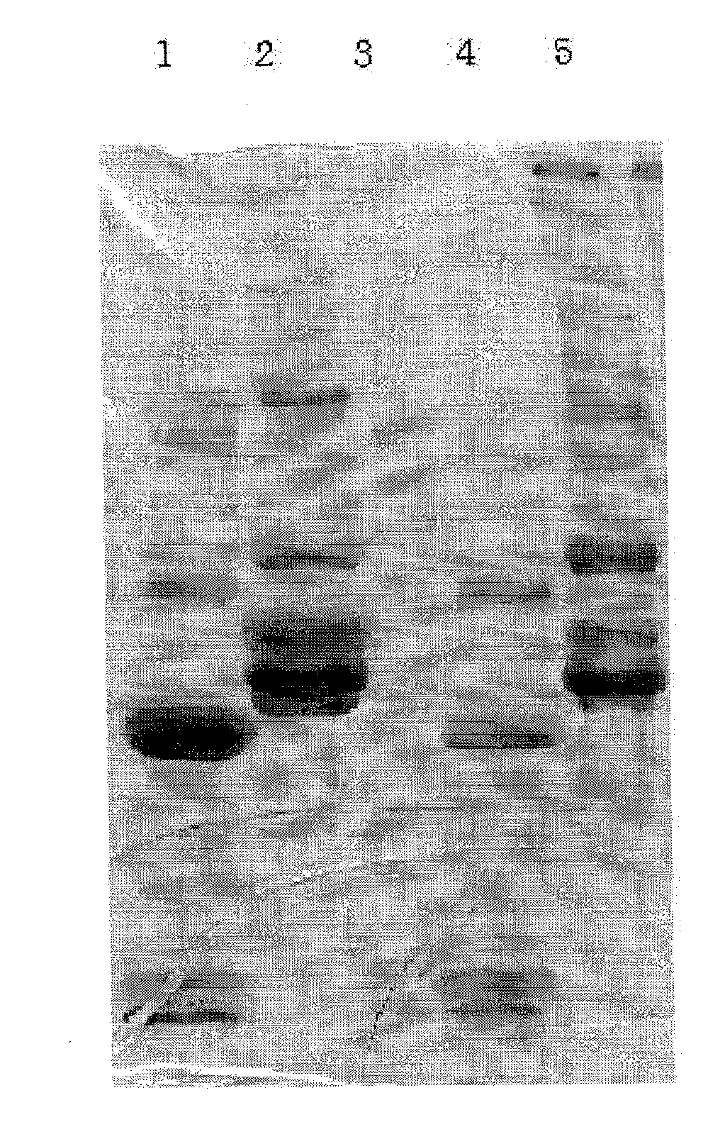 Monoclonal Antibody Against D-Dimer and Diagnosis Agent for Detecting D-Dimer, Crosslinked Fibrin and its Derivatives Containing D-Dimer by Using the Antibody