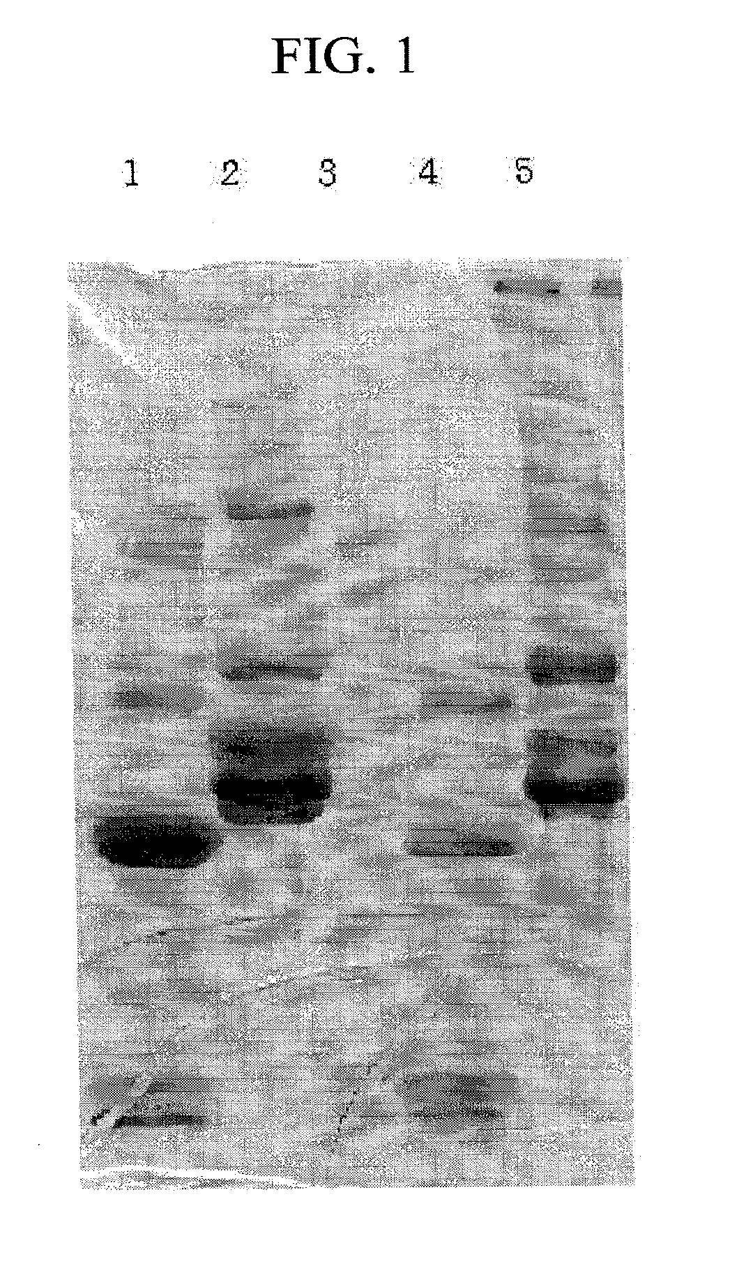 Monoclonal Antibody Against D-Dimer and Diagnosis Agent for Detecting D-Dimer, Crosslinked Fibrin and its Derivatives Containing D-Dimer by Using the Antibody