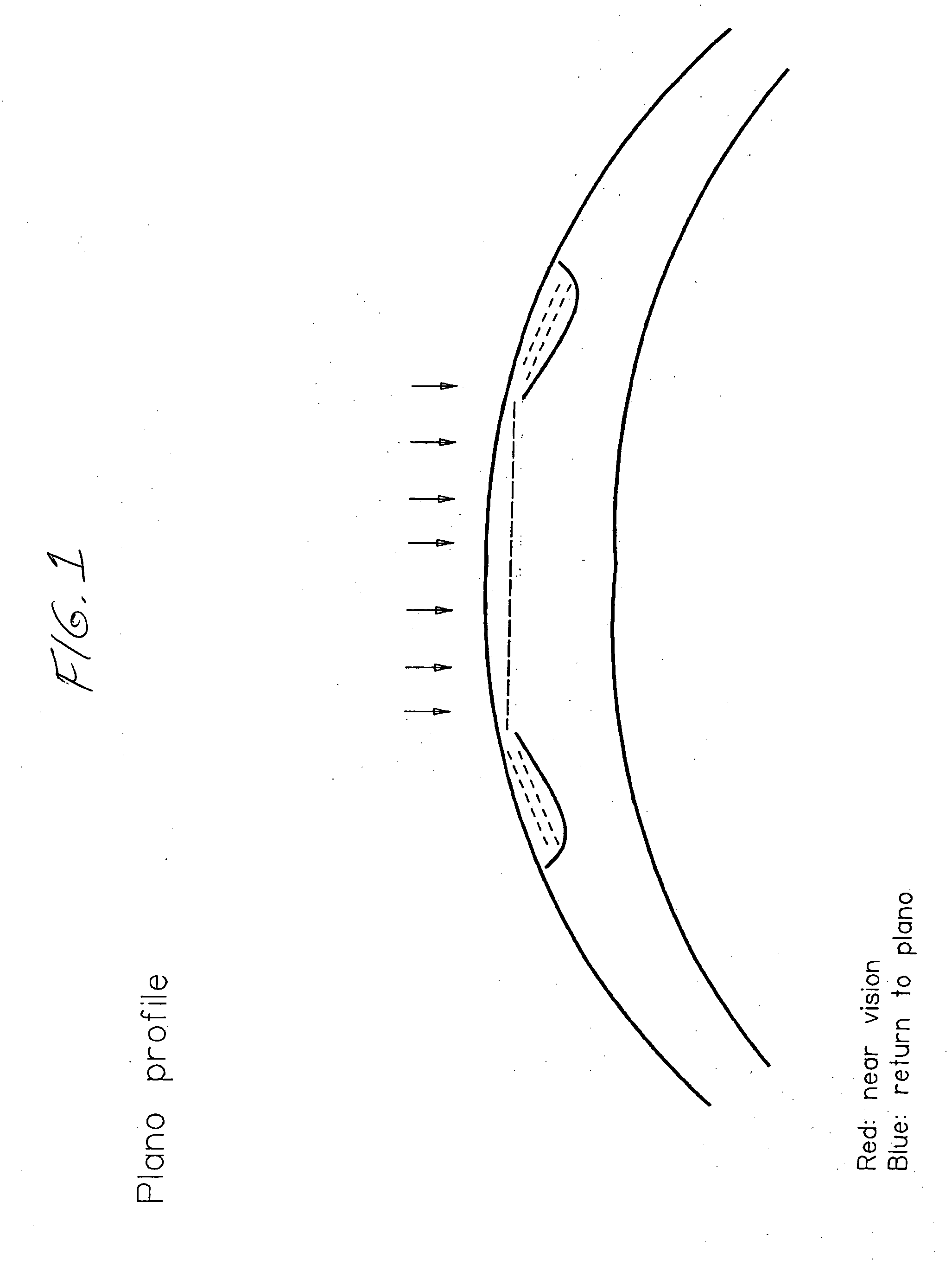 Apparatus for correcting presbyopia