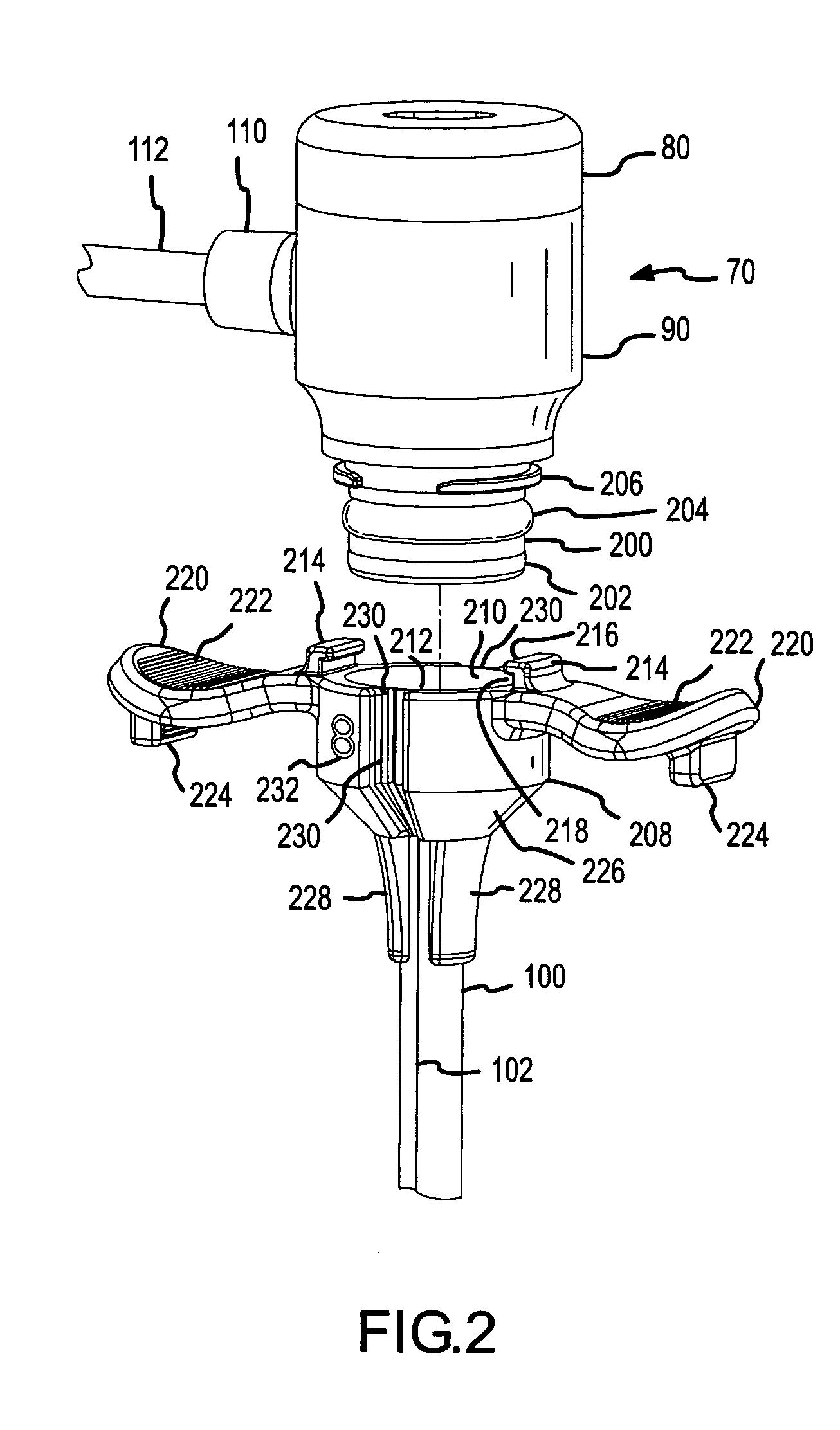 Detachable hemostasis valve and splittable sheath assembly