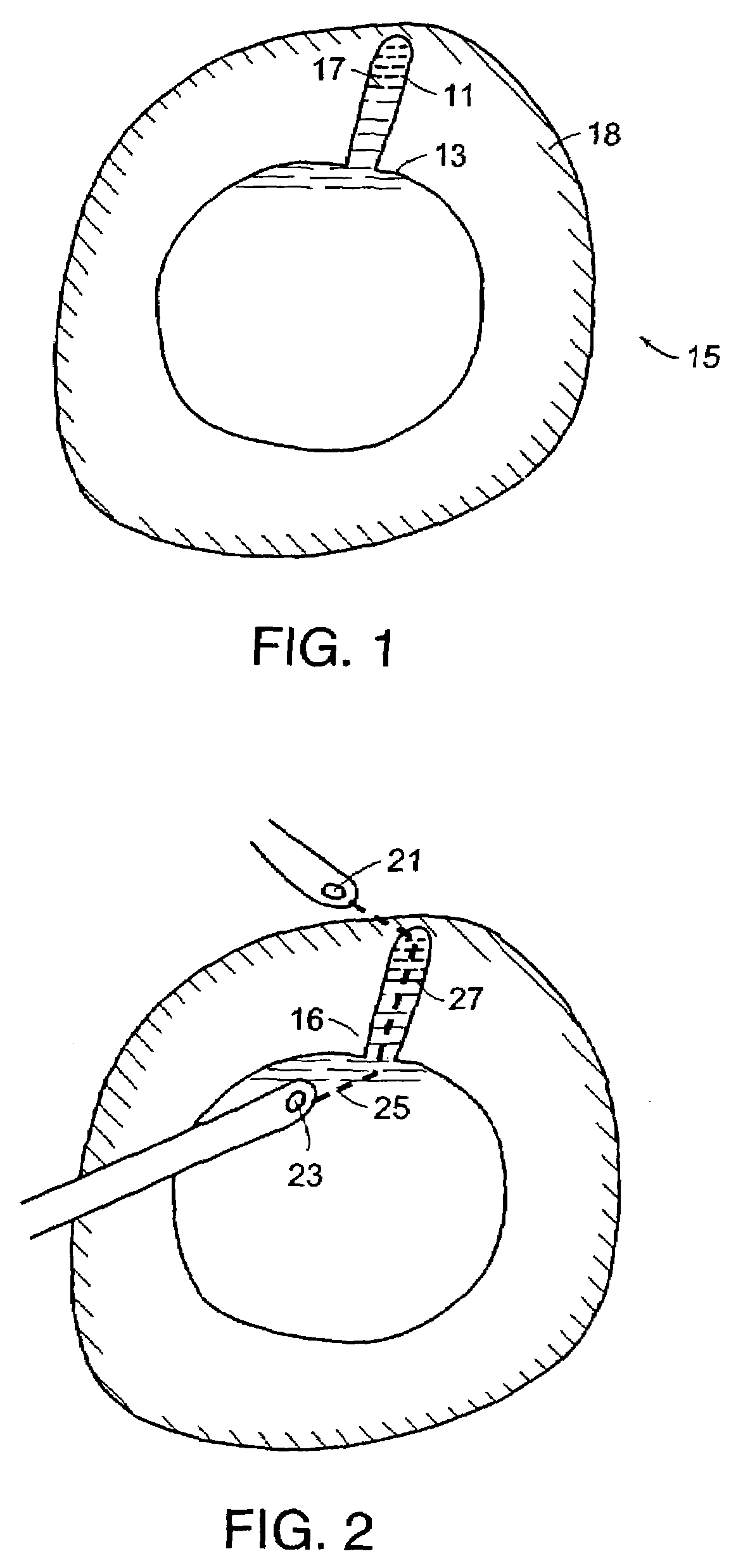 Thermal coagulation using hyperconductive fluids