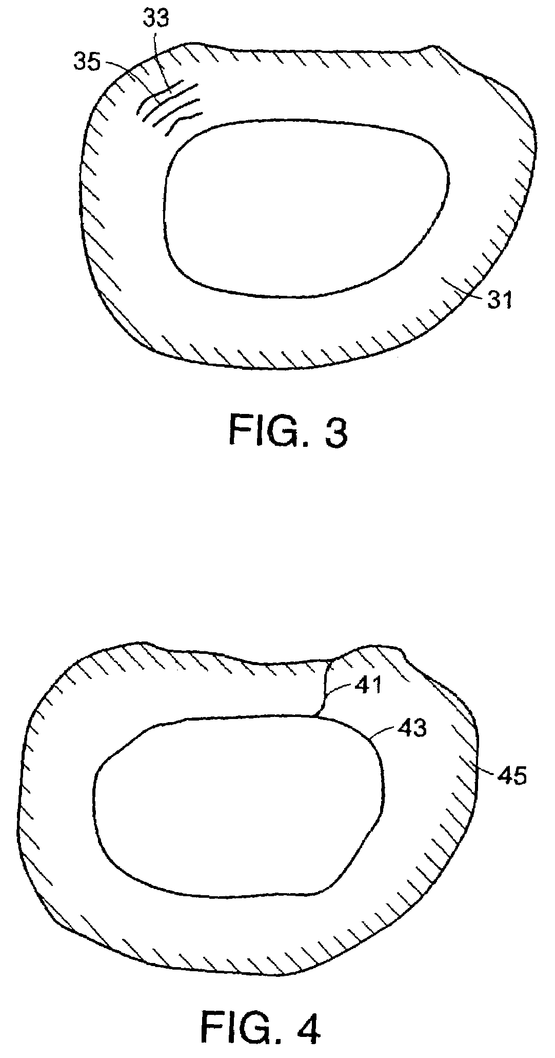 Thermal coagulation using hyperconductive fluids