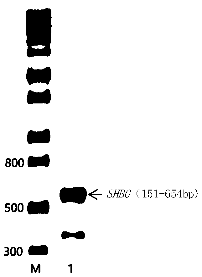 Method for expressing and purifying recombinant human sex hormone haptoglobin N-terminal 51-218aa