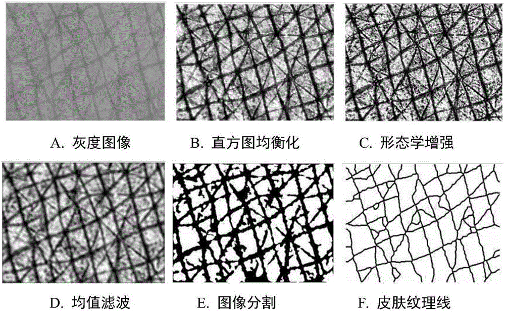 Noninvasive age estimation method based on skin texture information