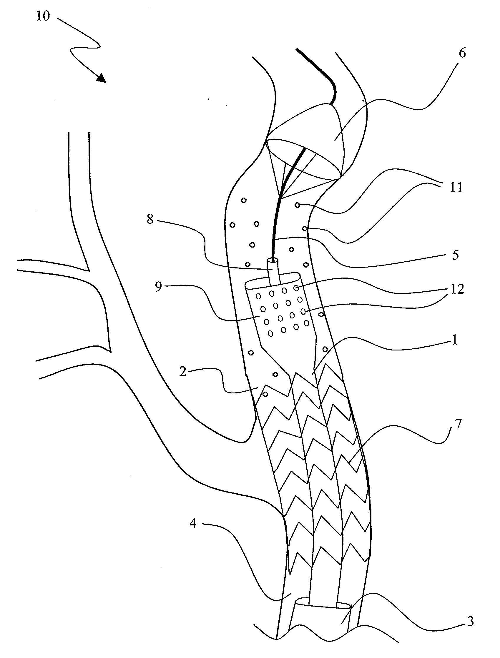 Vascular catheter with aspiration capabilities and expanded distal tip