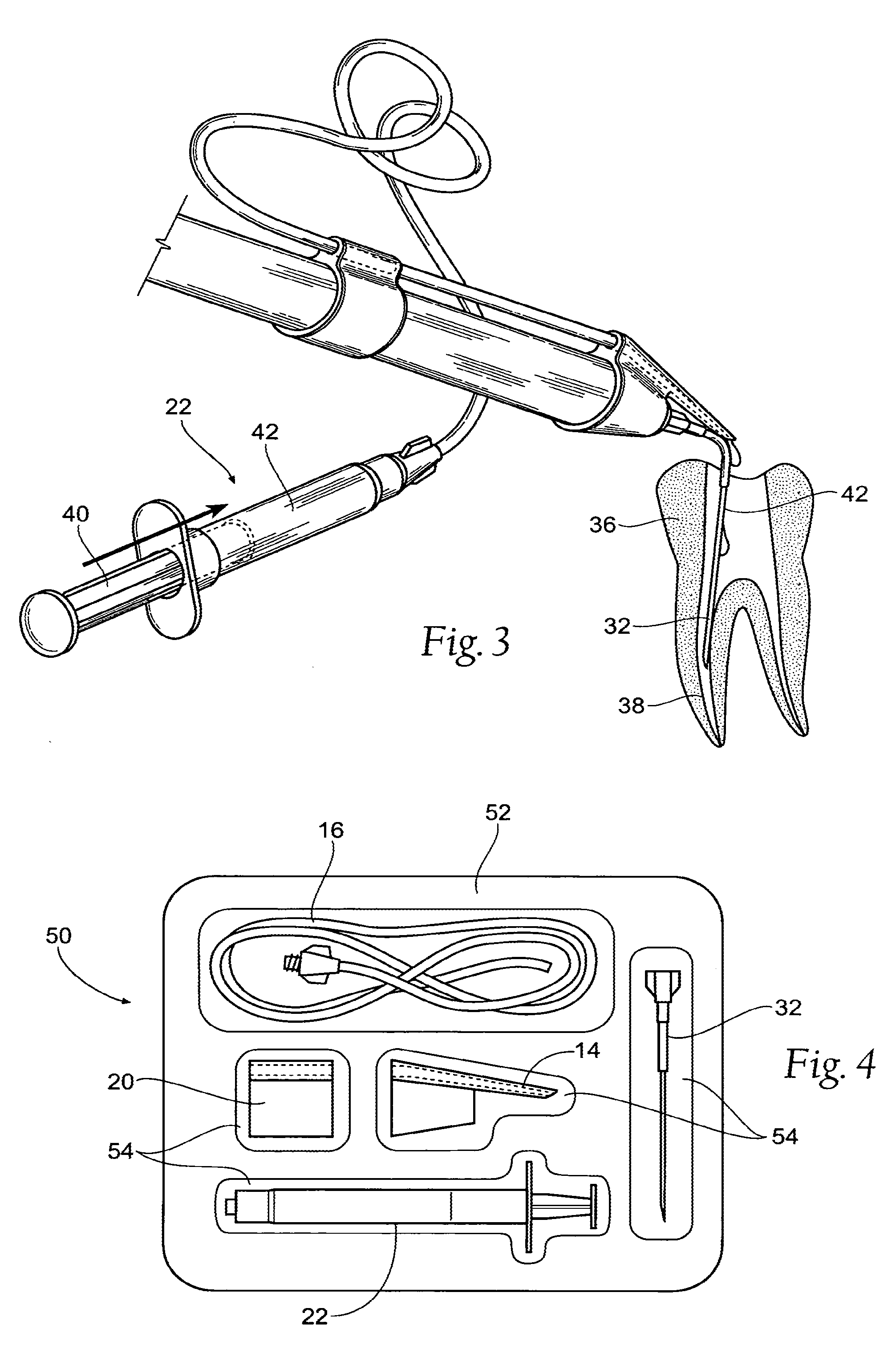 Fluid Bypass Device for Handheld Dental Devices