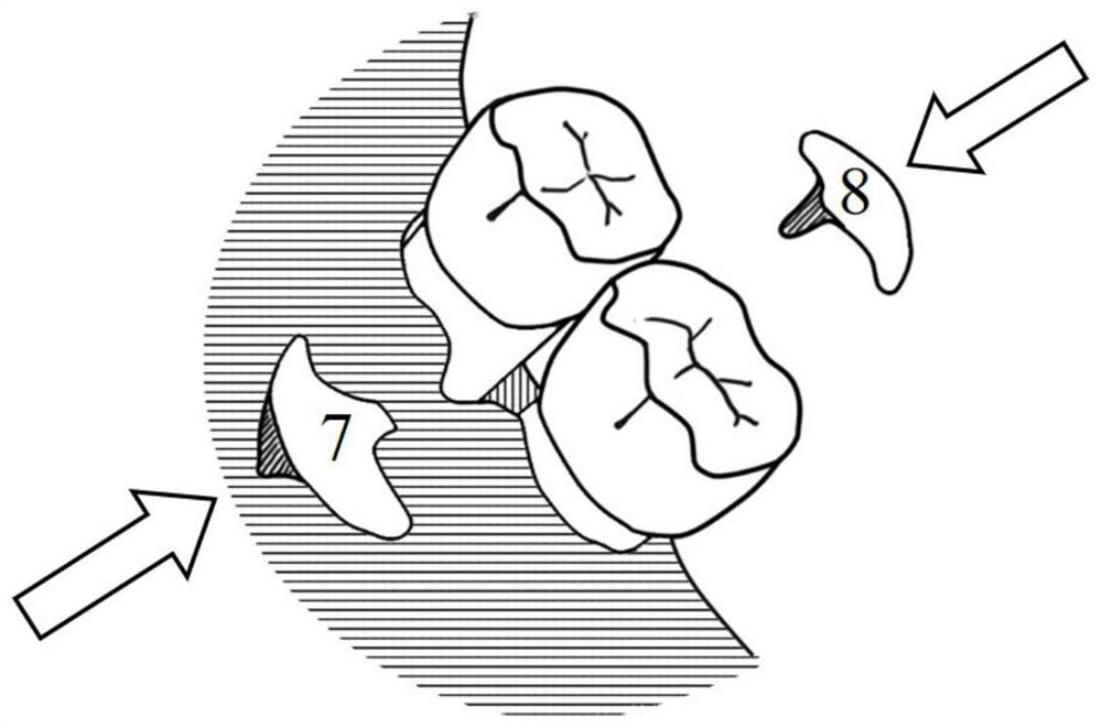 Preparation method of regional function specific clinical periodontal defect repair module