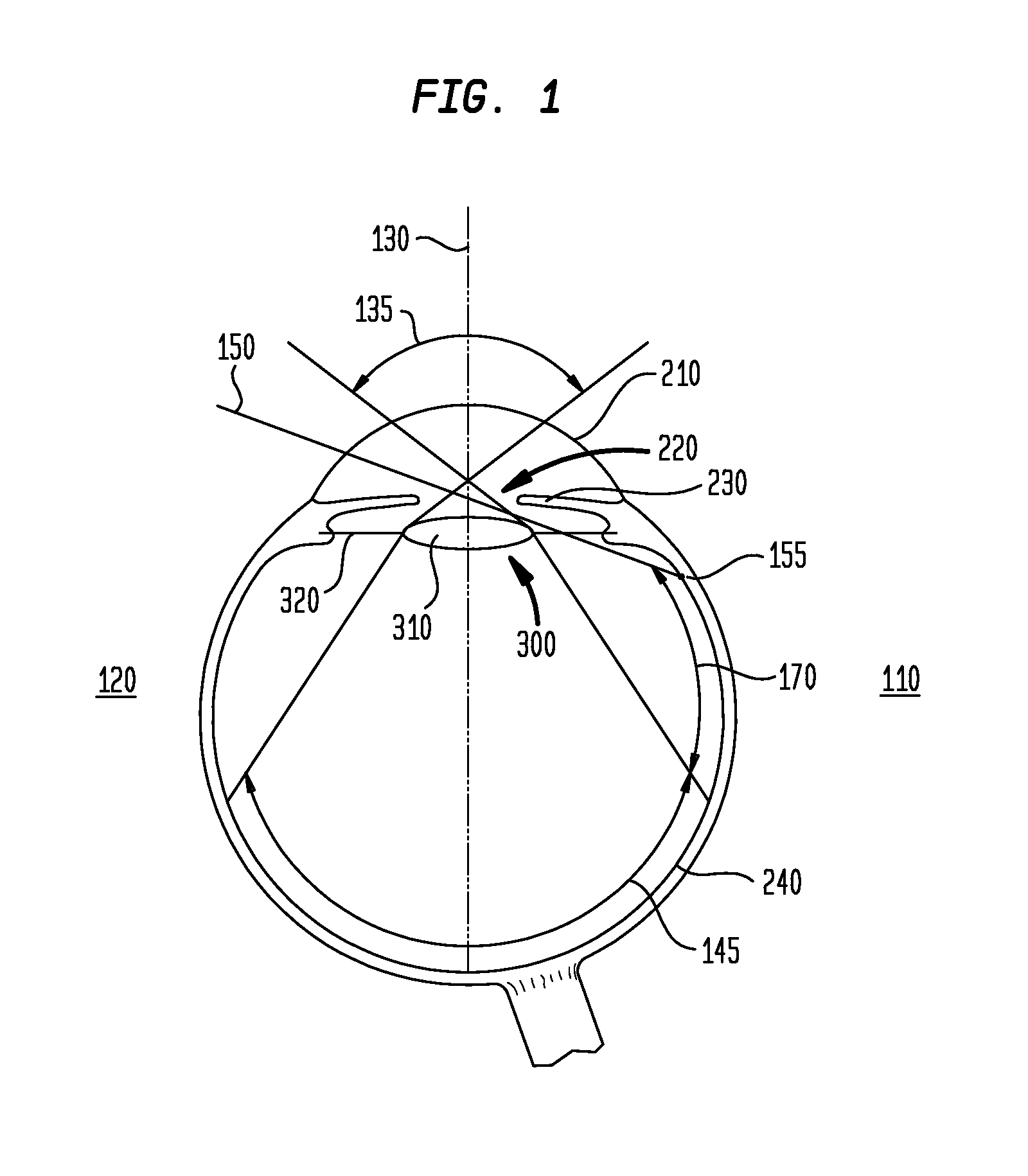 Haptic Junction Designs to Reduce Negative Dysphotopsia