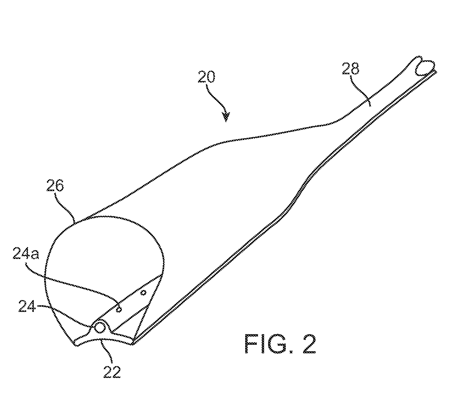 Methods and devices to treat compressive neuropathy and other diseases