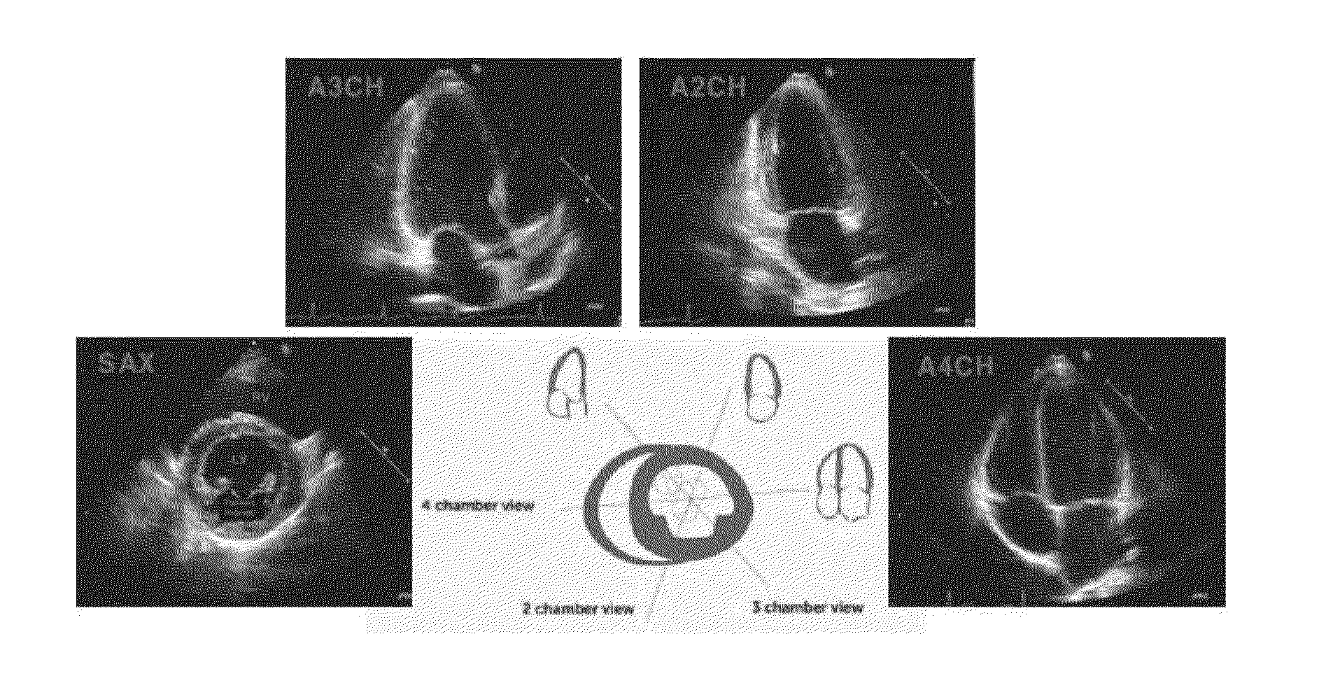 Apparatus and method for processing echocardiogram using navier-stokes equation